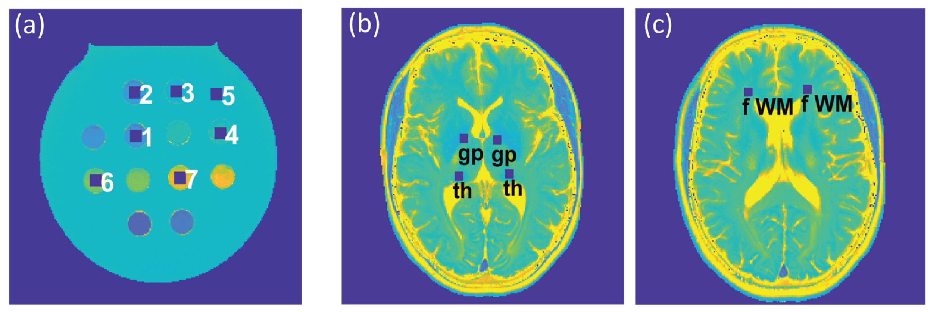 Tomography 09 00024 g002