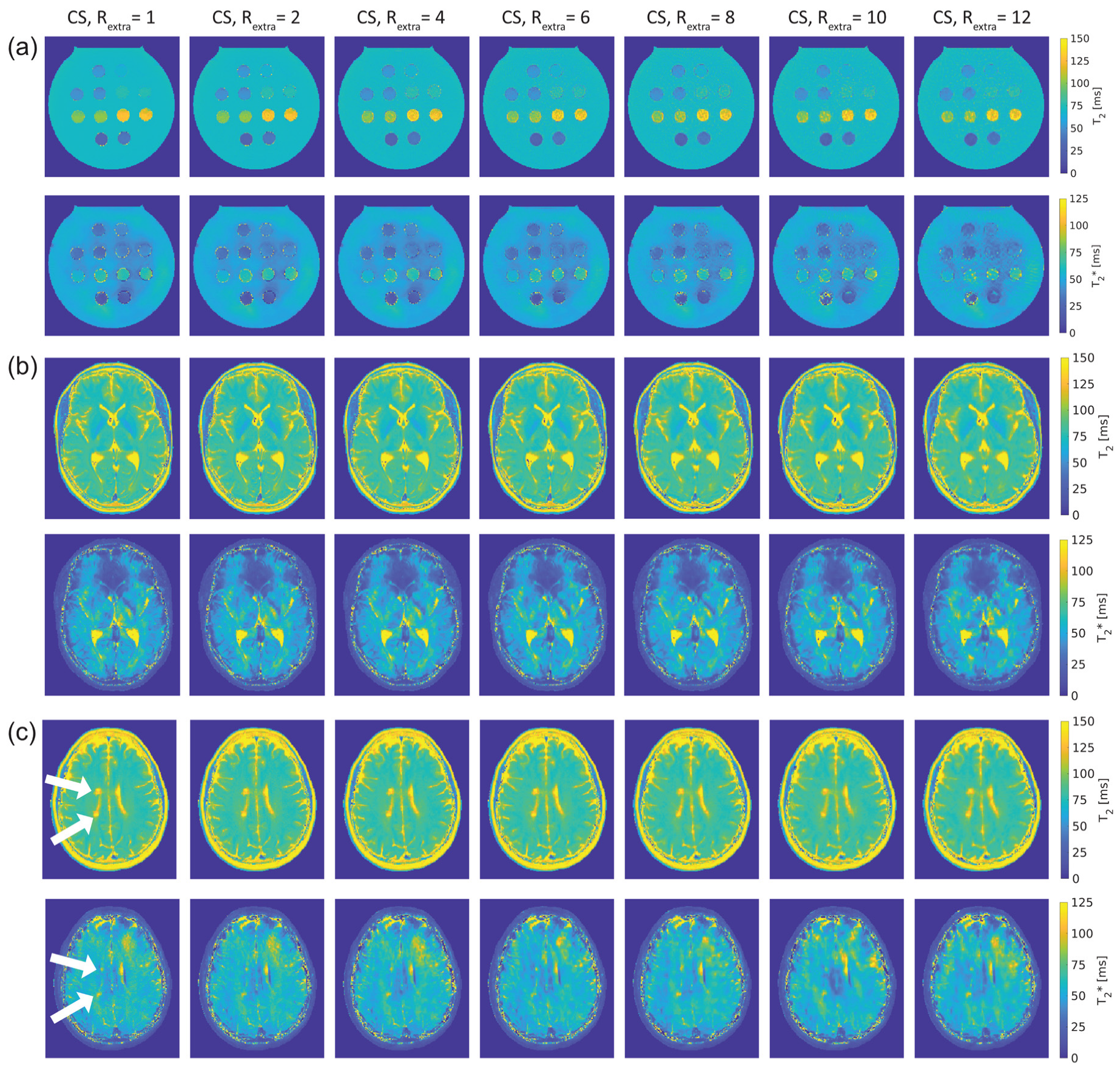 Tomography 09 00024 g003