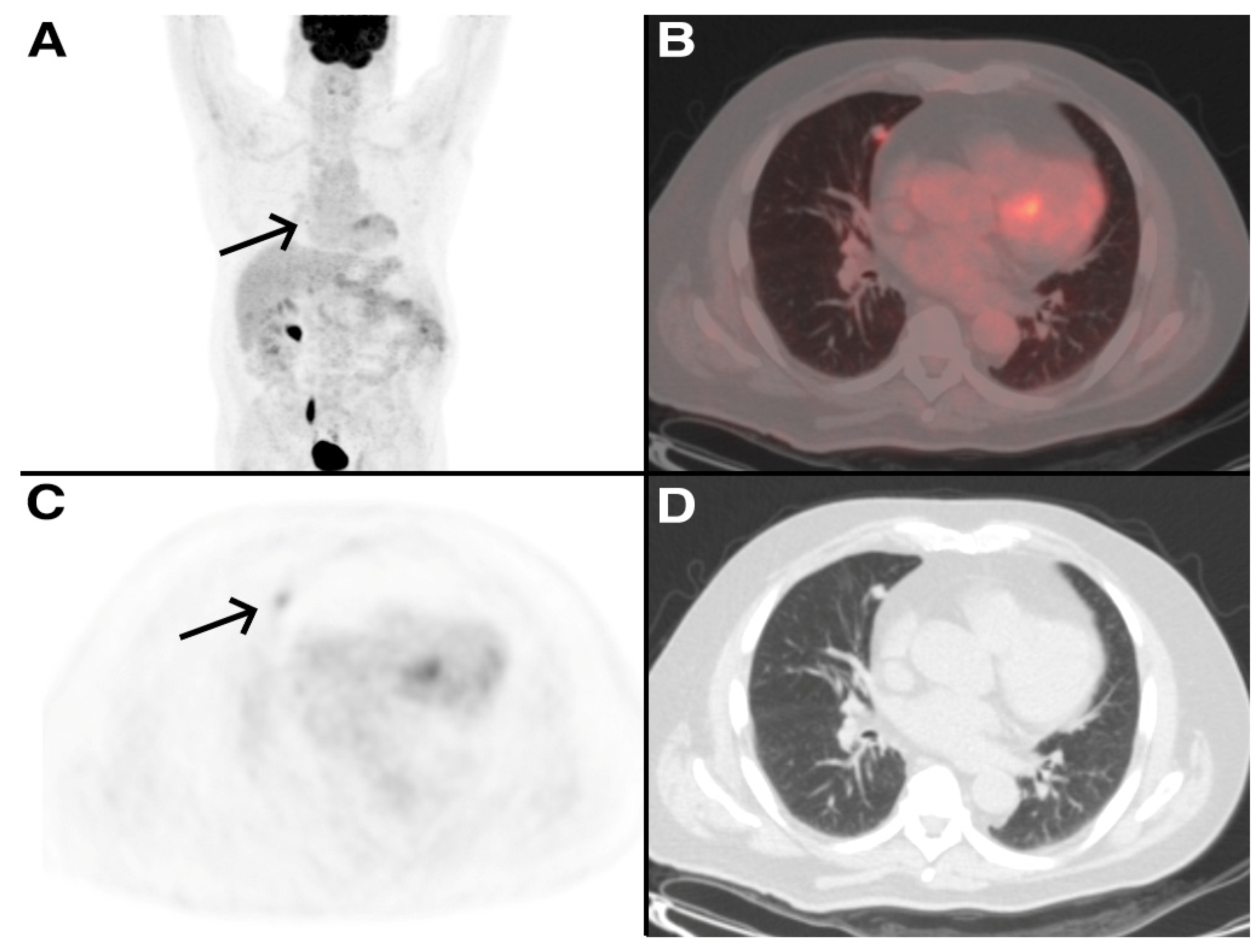 Tomography 09 00031 g003 Tomography 09 00031 g003