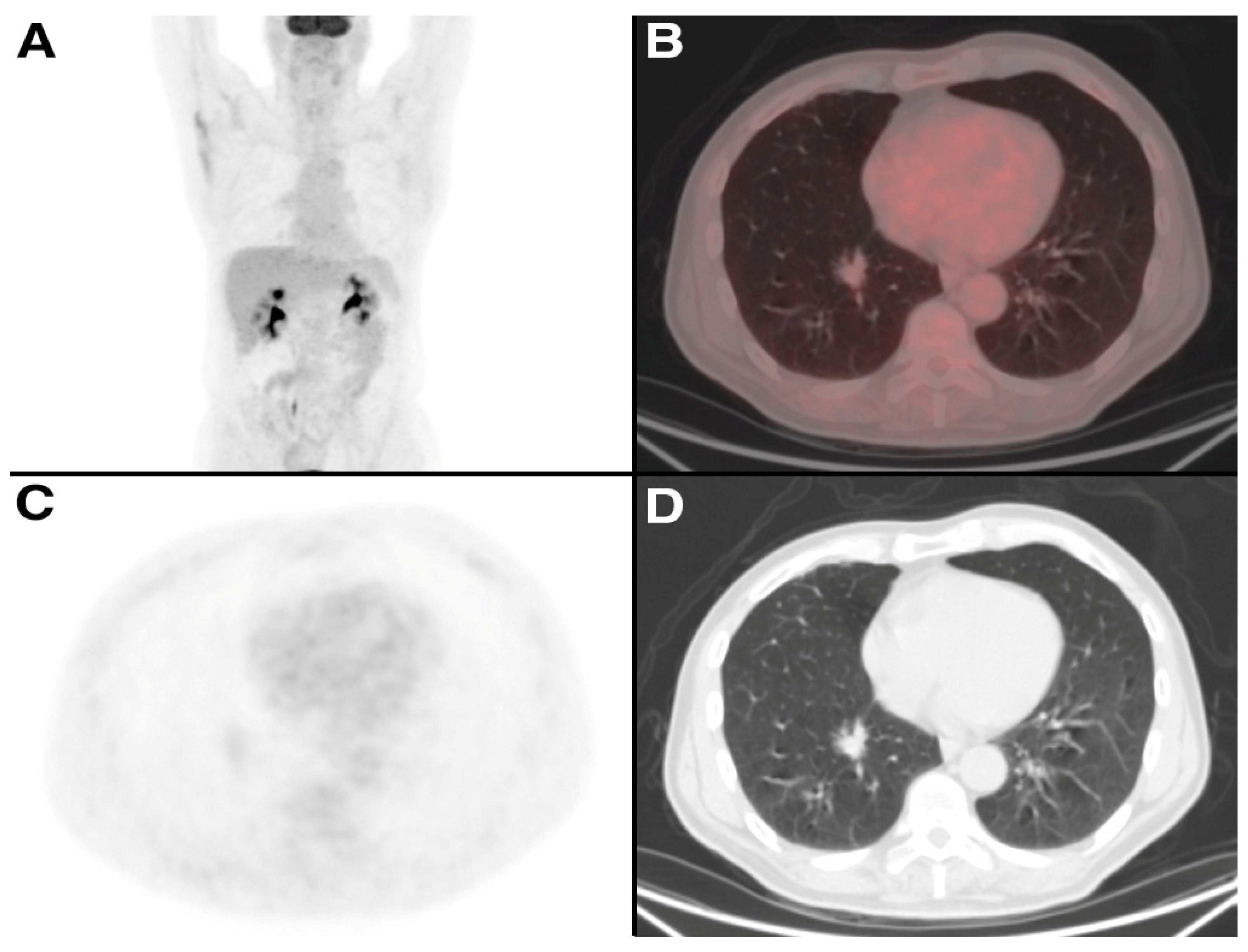 Tomography 09 00031 g004 Tomography 09 00031 g004