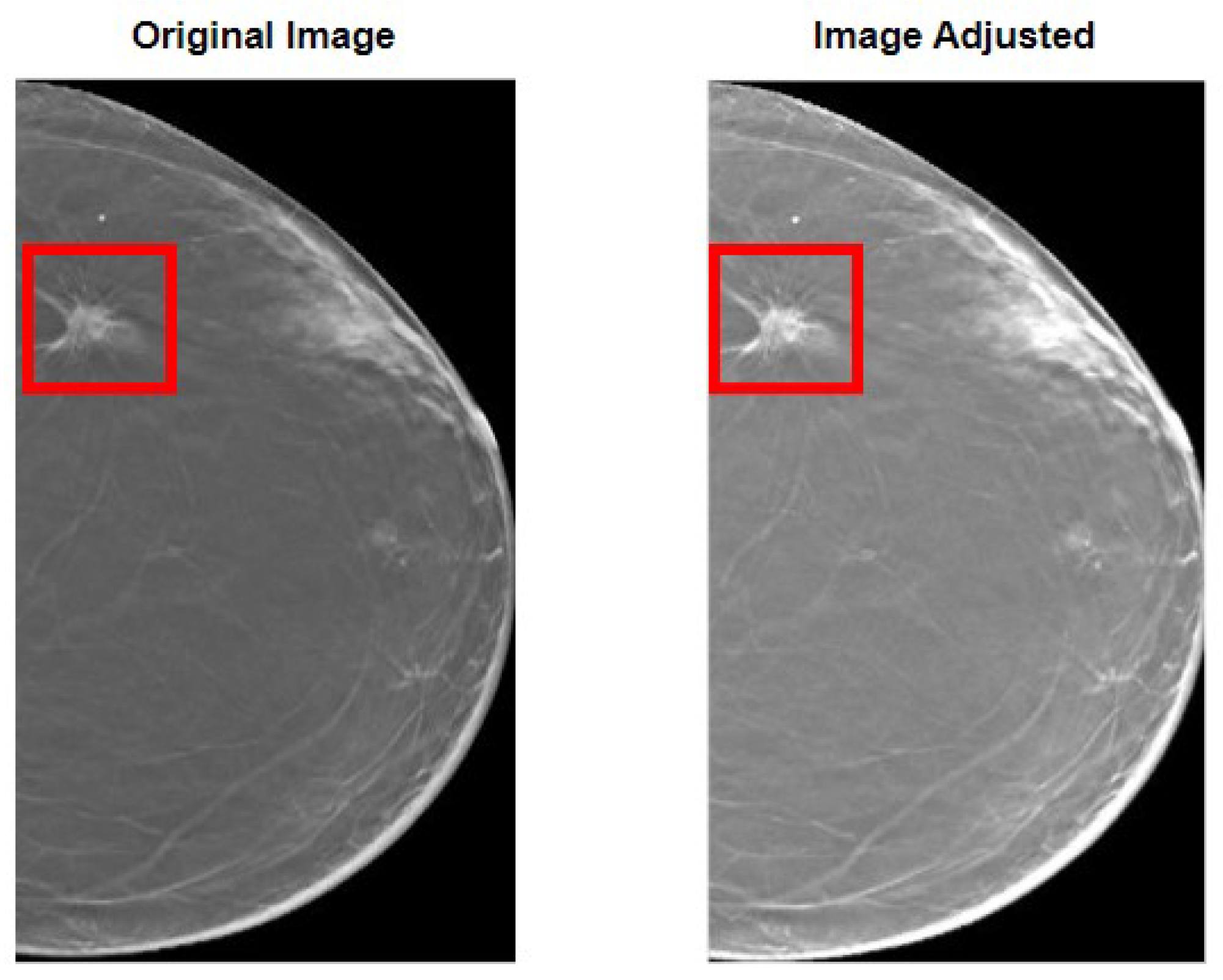 Tomography 09 00032 g003 550