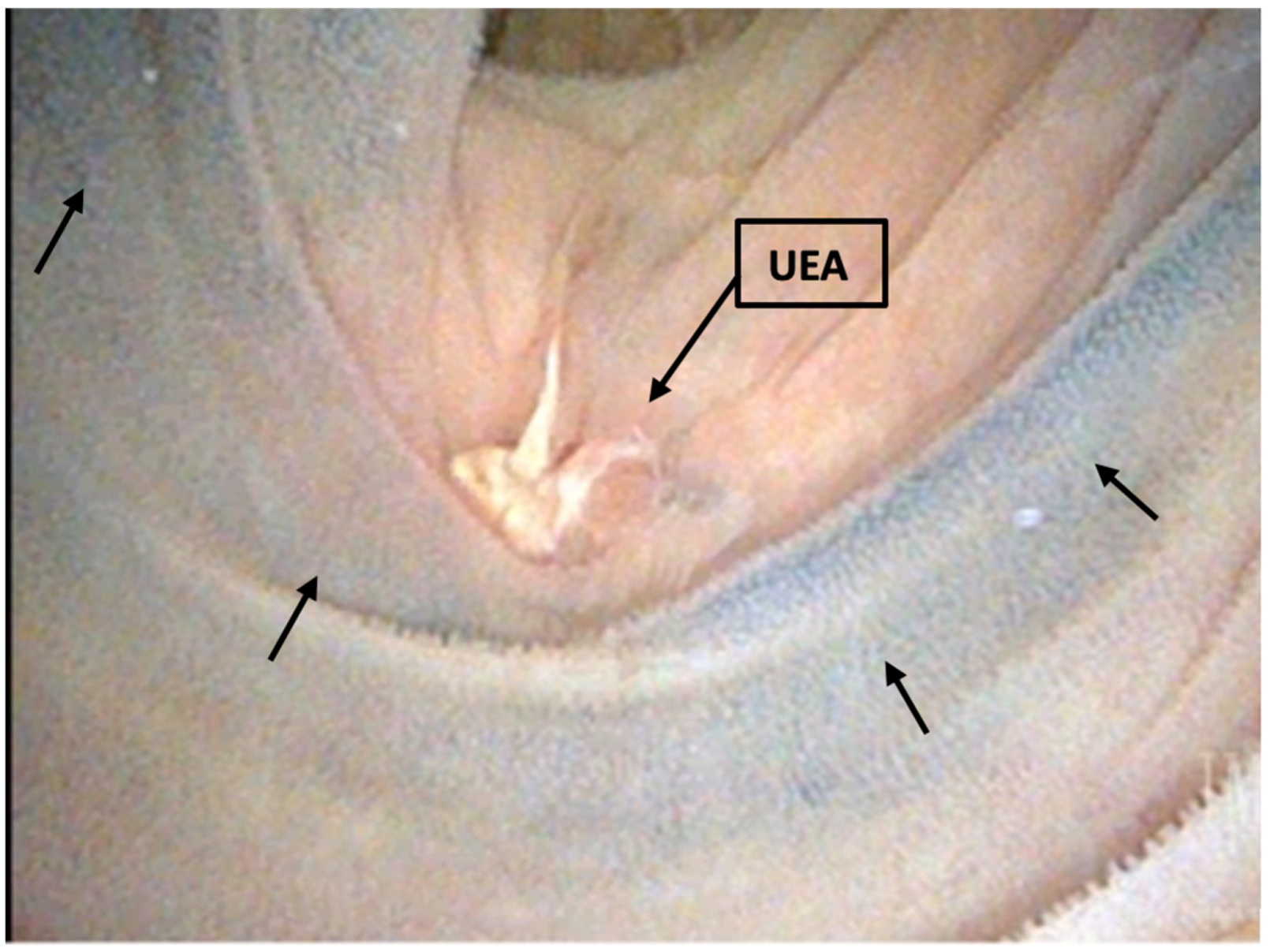 Tomography 09 00037 g002 Tomography 09 00037 g002