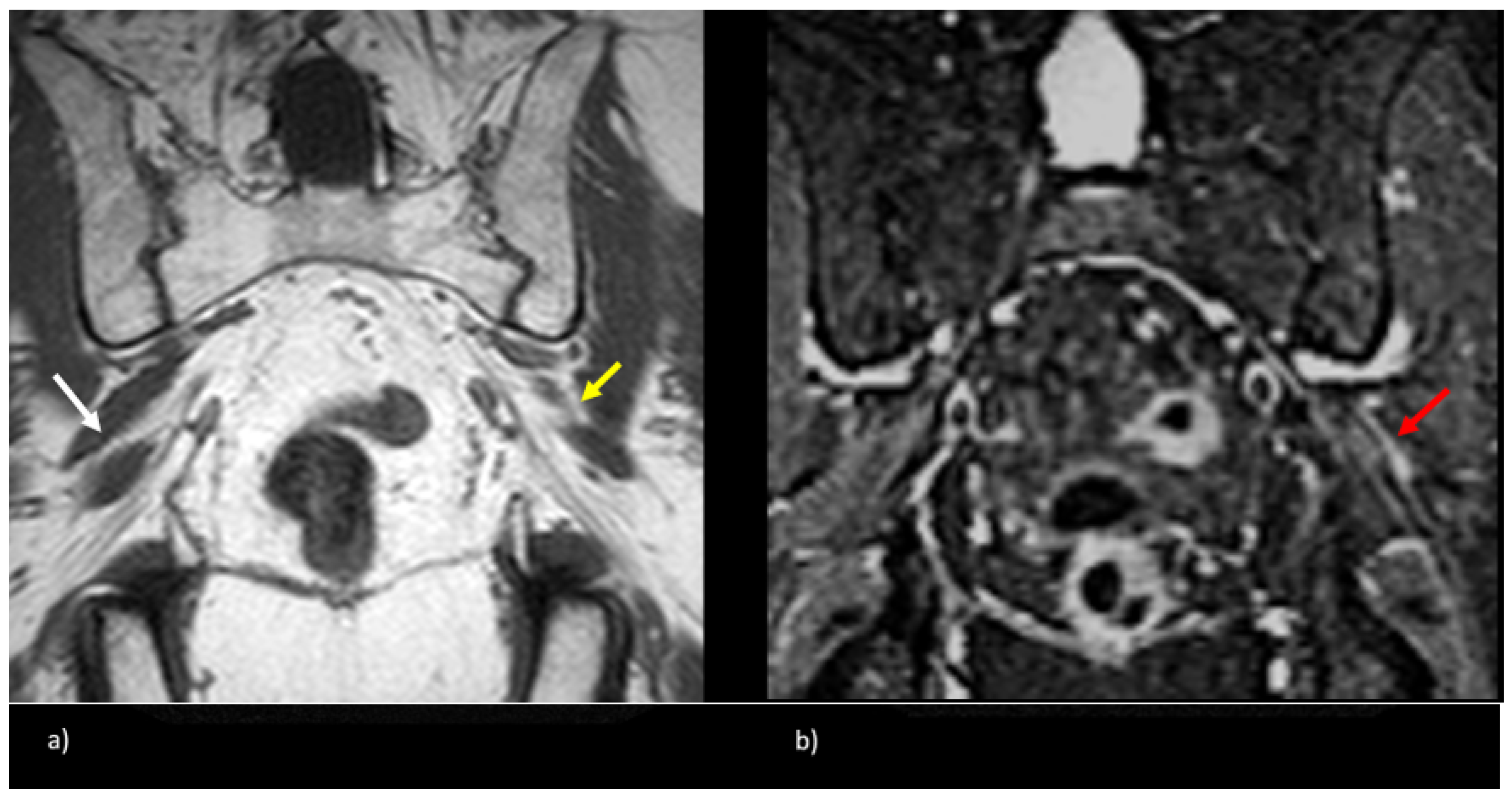 Tomography 09 00039 g005