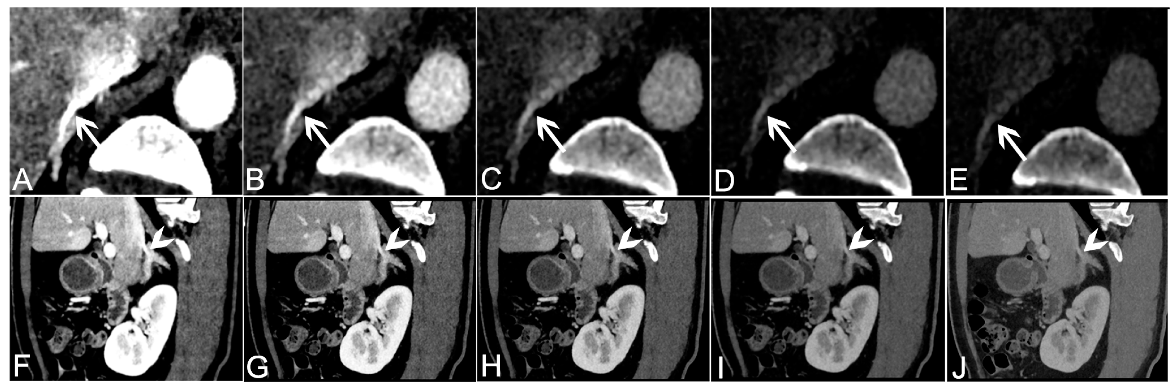 Tomography 09 00040 g002 Tomography 09 00040 g002