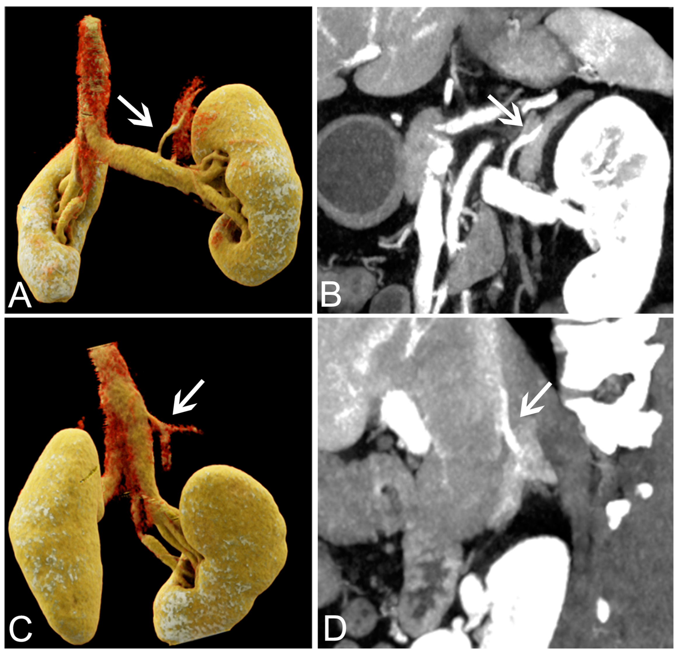 Tomography 09 00040 g003 Tomography 09 00040 g003