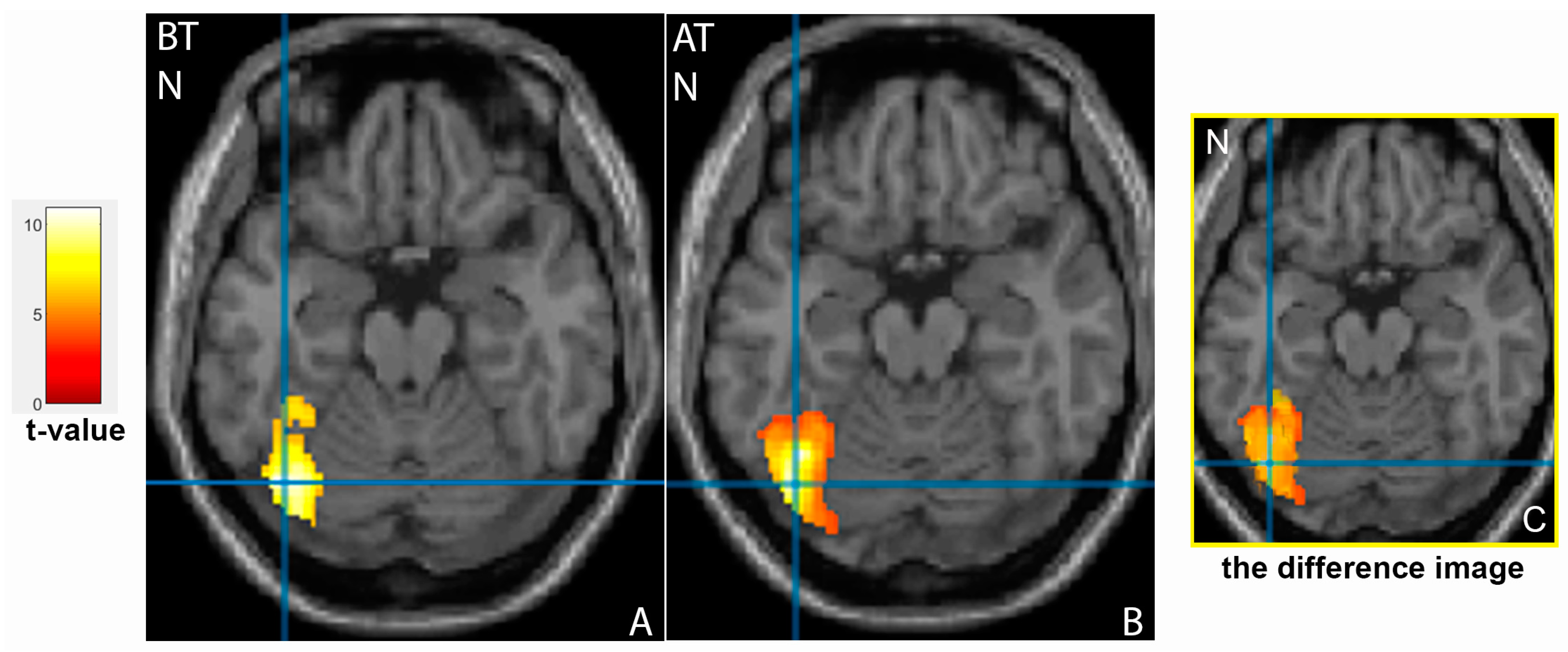 Tomography 09 00043 g003