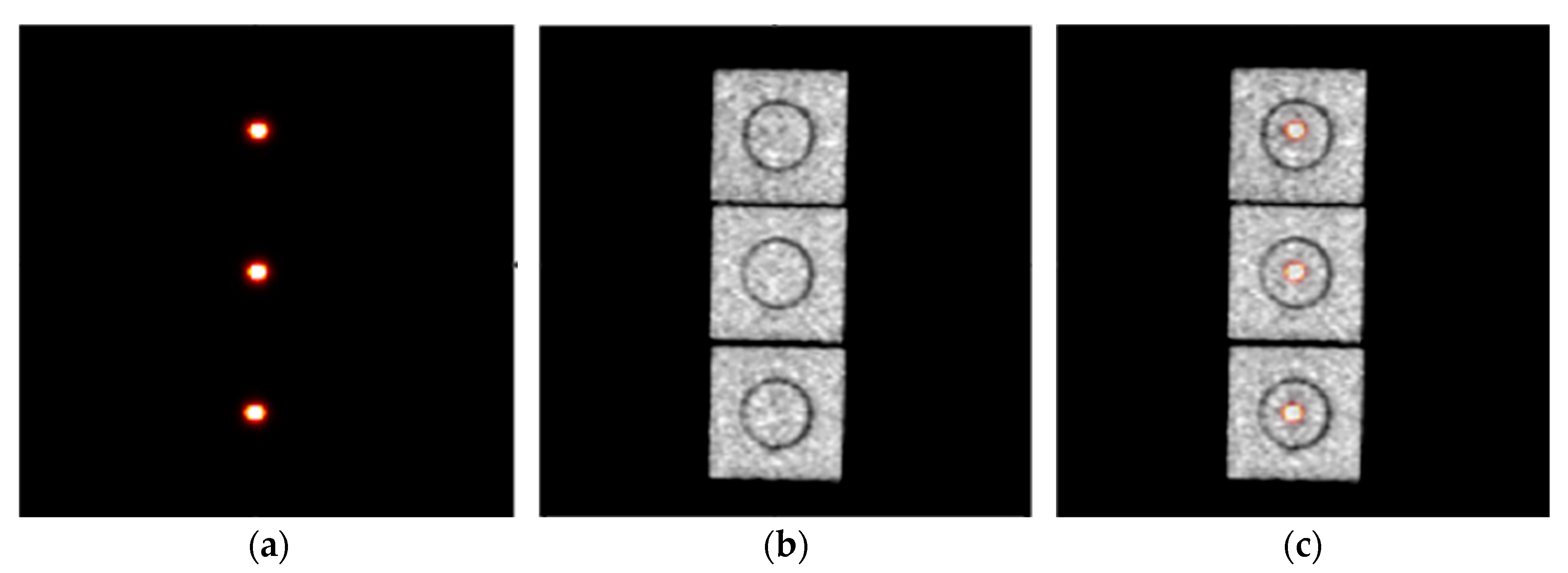 Tomography 09 00046 g004 Tomography 09 00046 g004