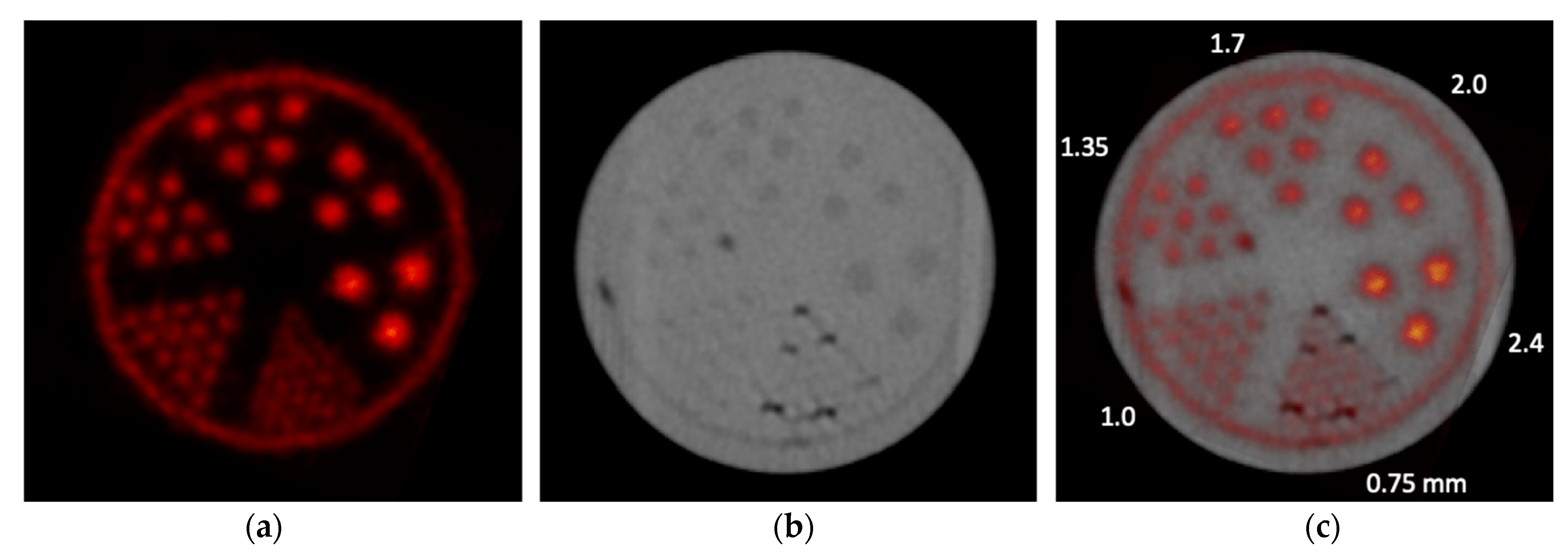 Tomography 09 00046 g005 Tomography 09 00046 g005