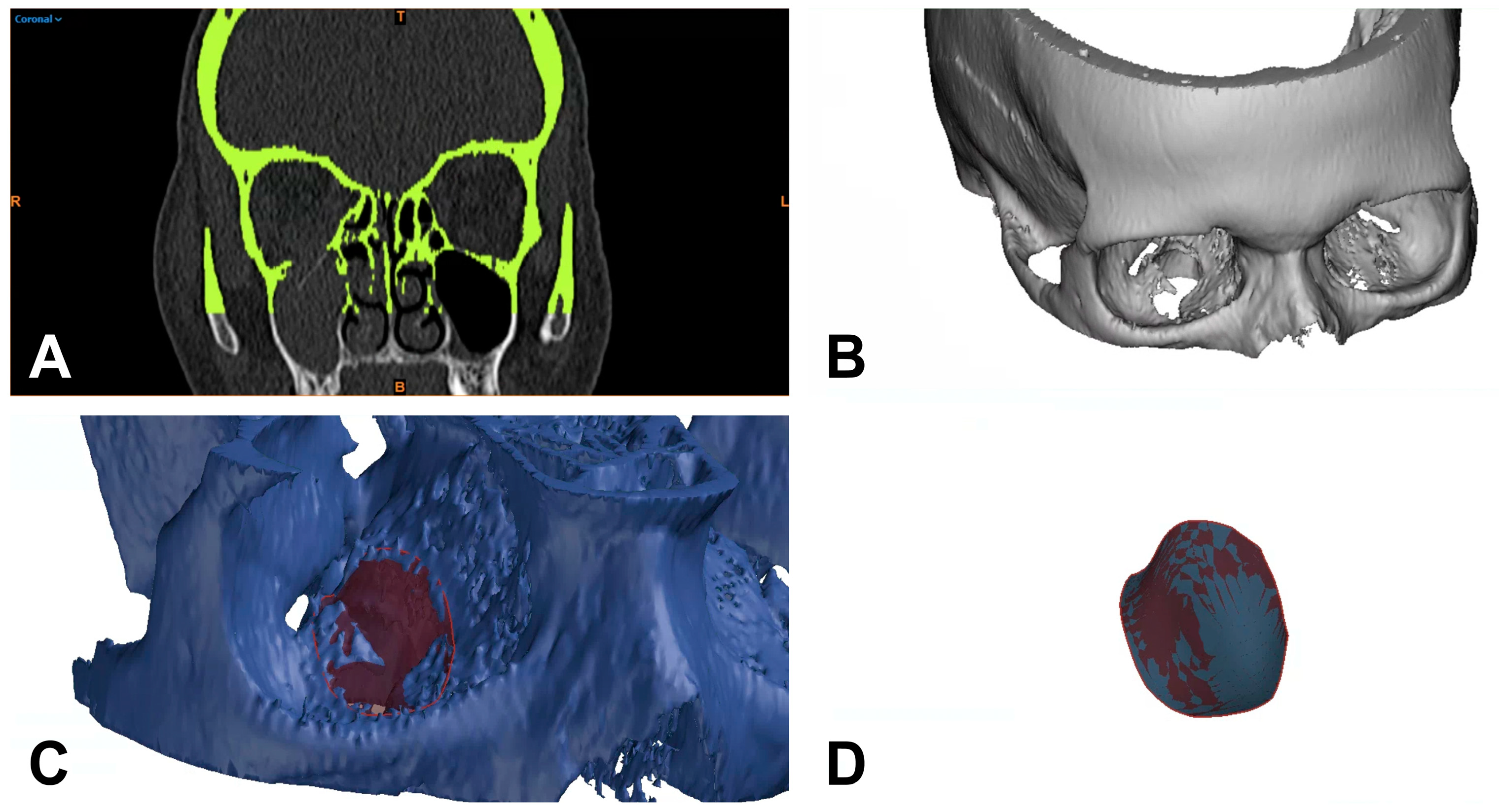 Tomography 09 00047 g002 Tomography 09 00047 g002