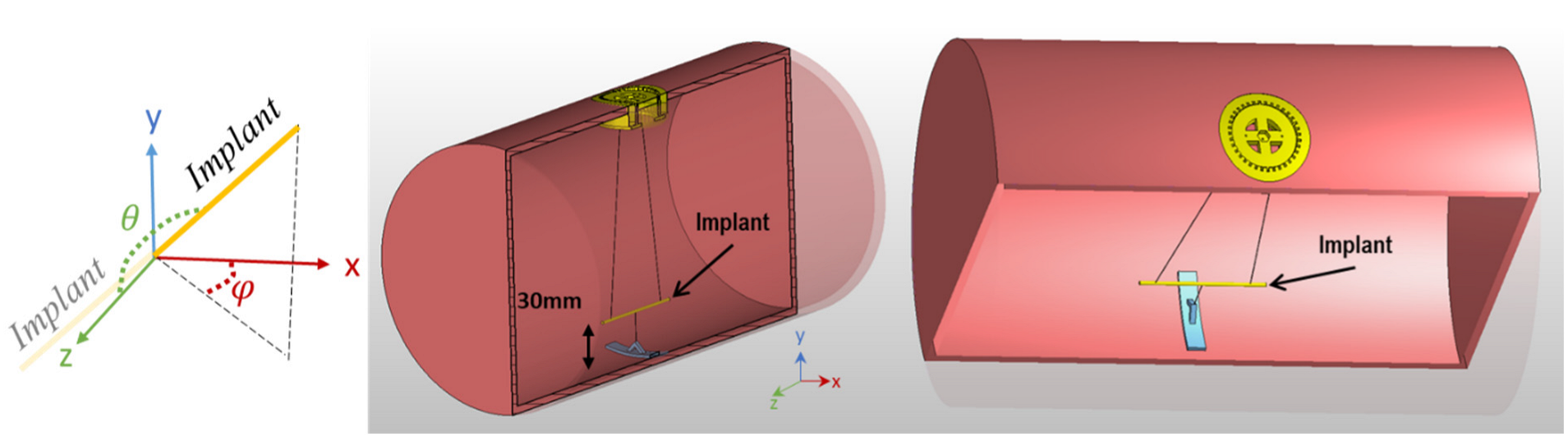 Tomography 09 00049 g002