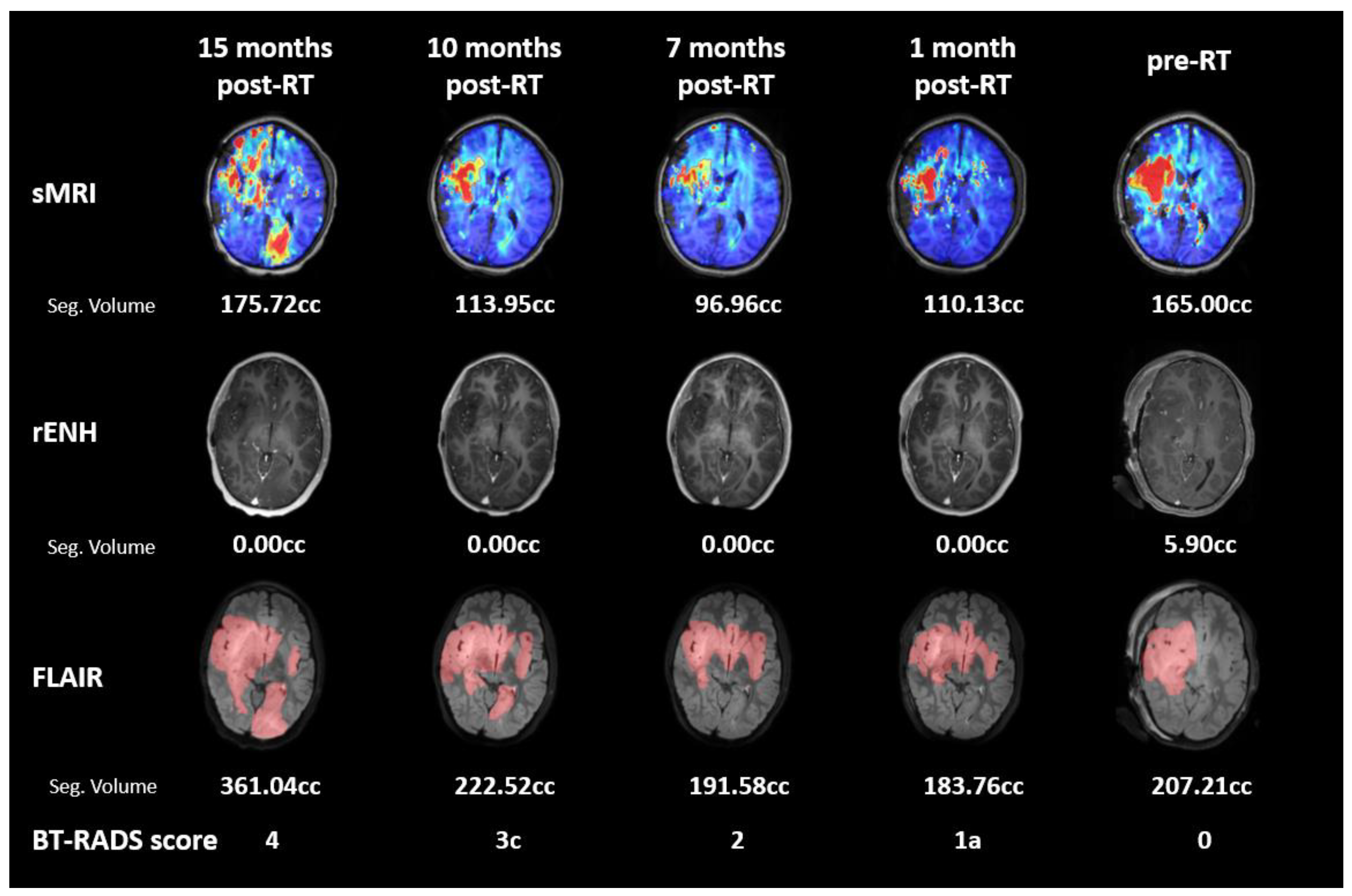 Tomography 09 00051 g004 Tomography 09 00051 g004