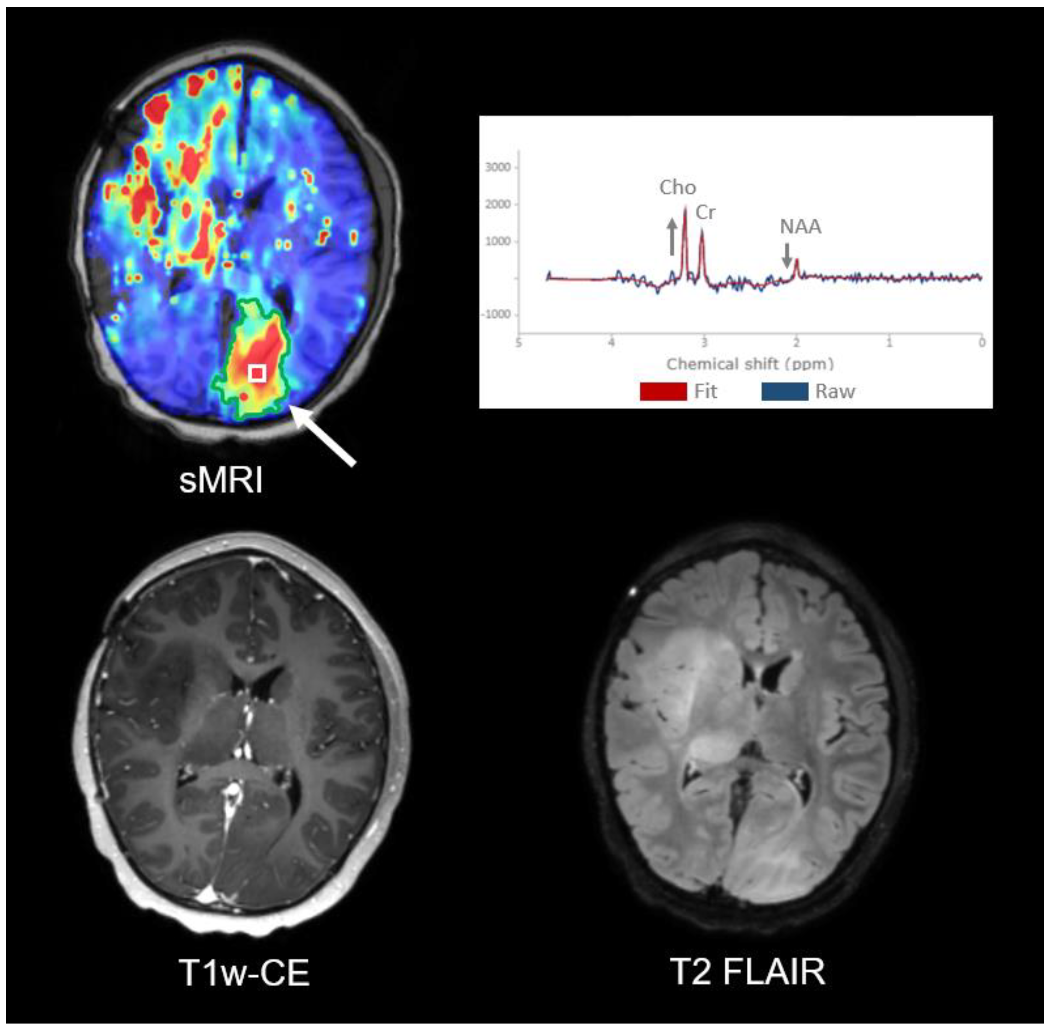 Tomography 09 00051 g005 Tomography 09 00051 g005
