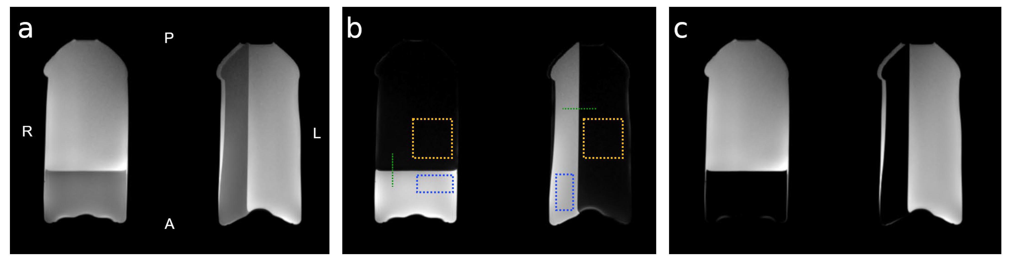 Tomography 09 00055 g001