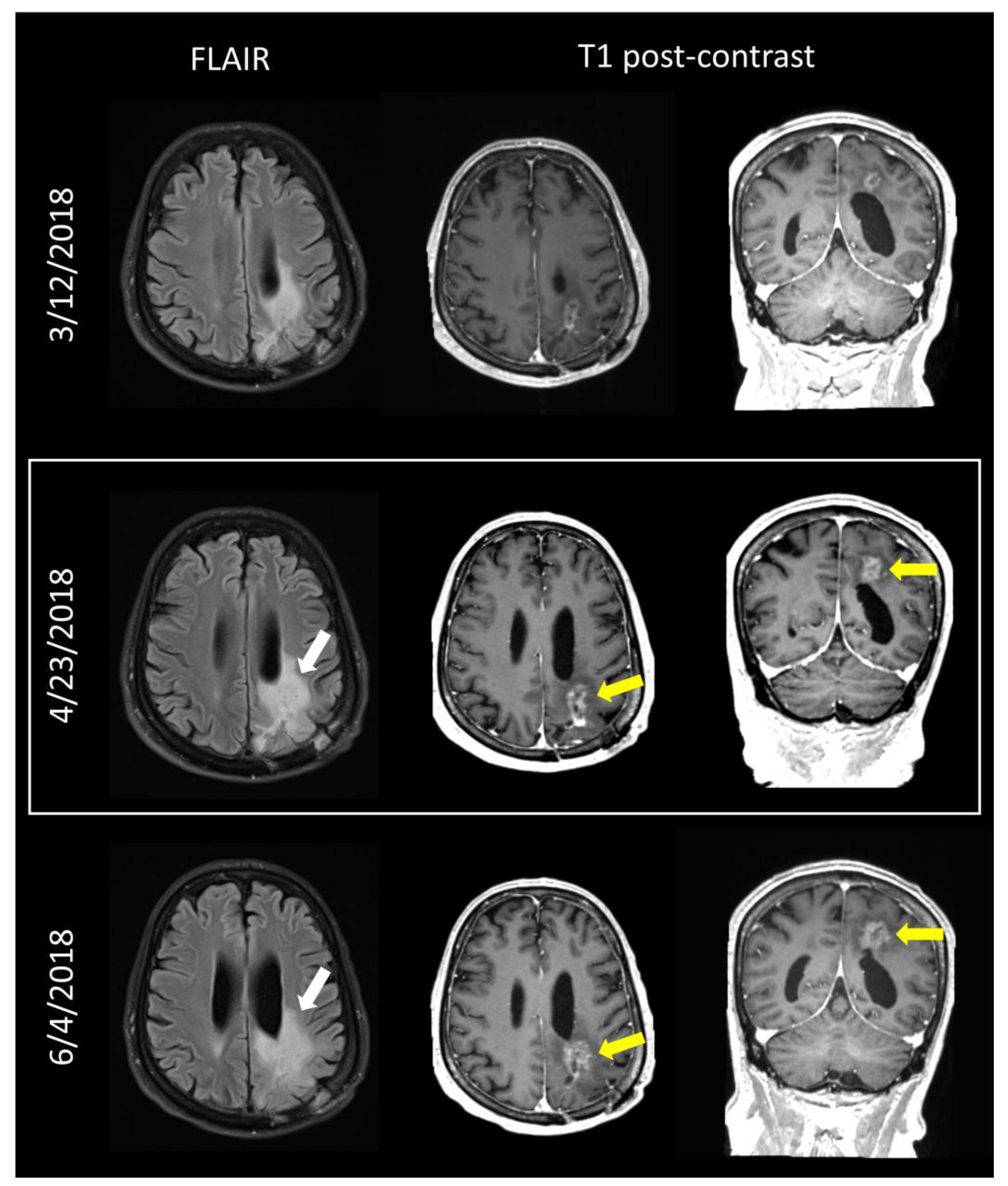 Tomography 09 00070 g004