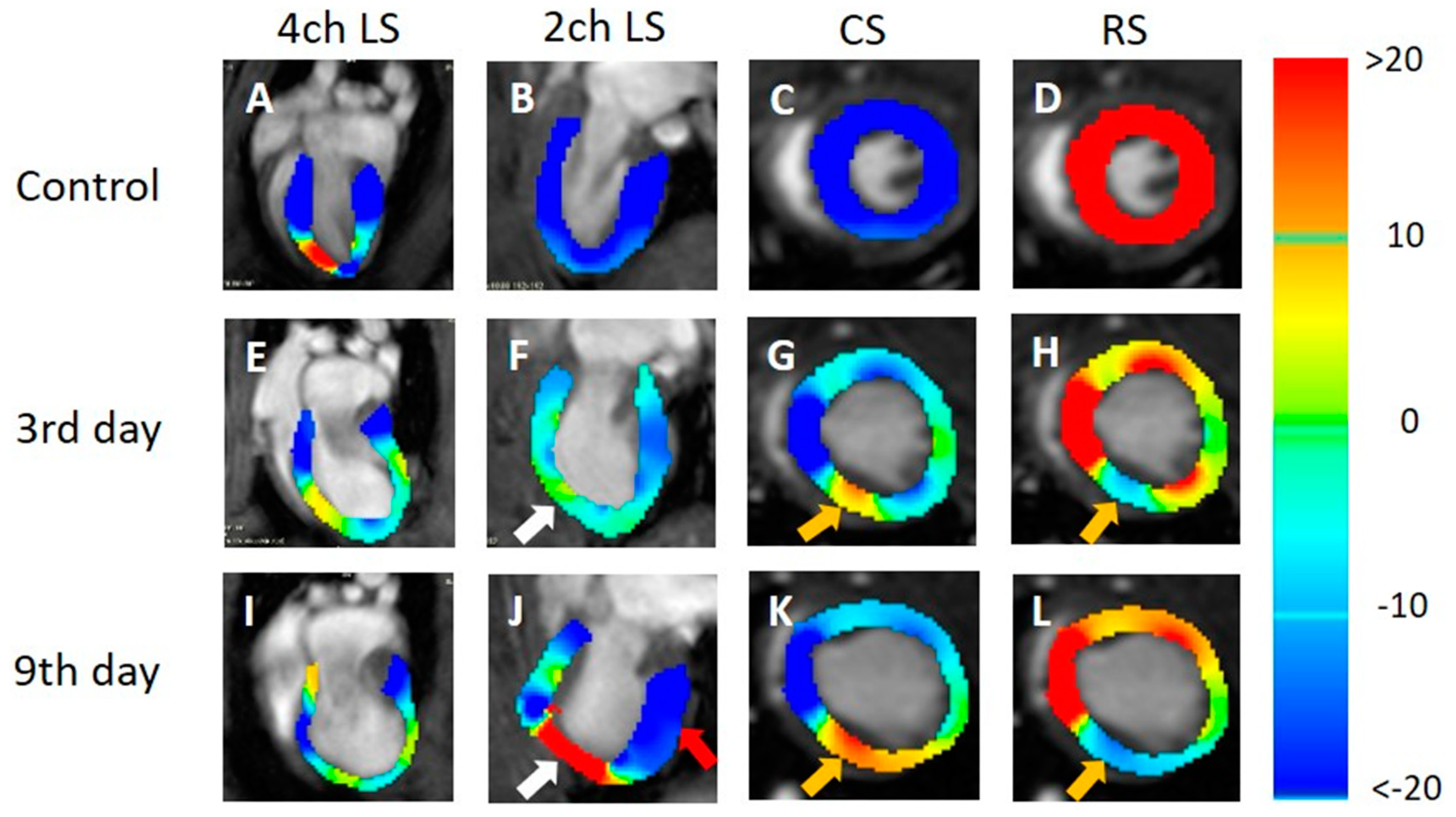 Tomography 09 00071 g006 Tomography 09 00071 g006