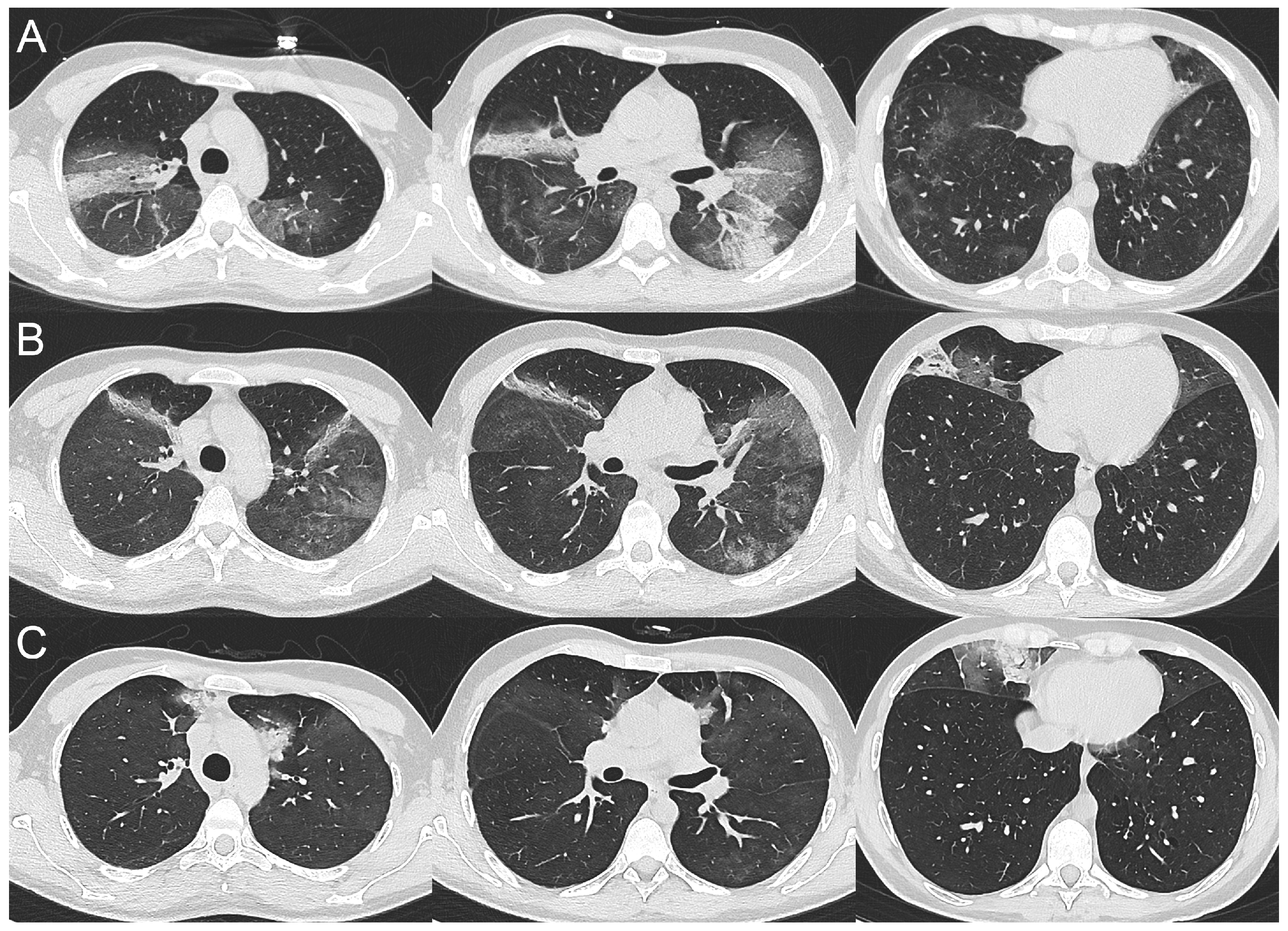 Tomography 09 00073 g001 Tomography 09 00073 g001