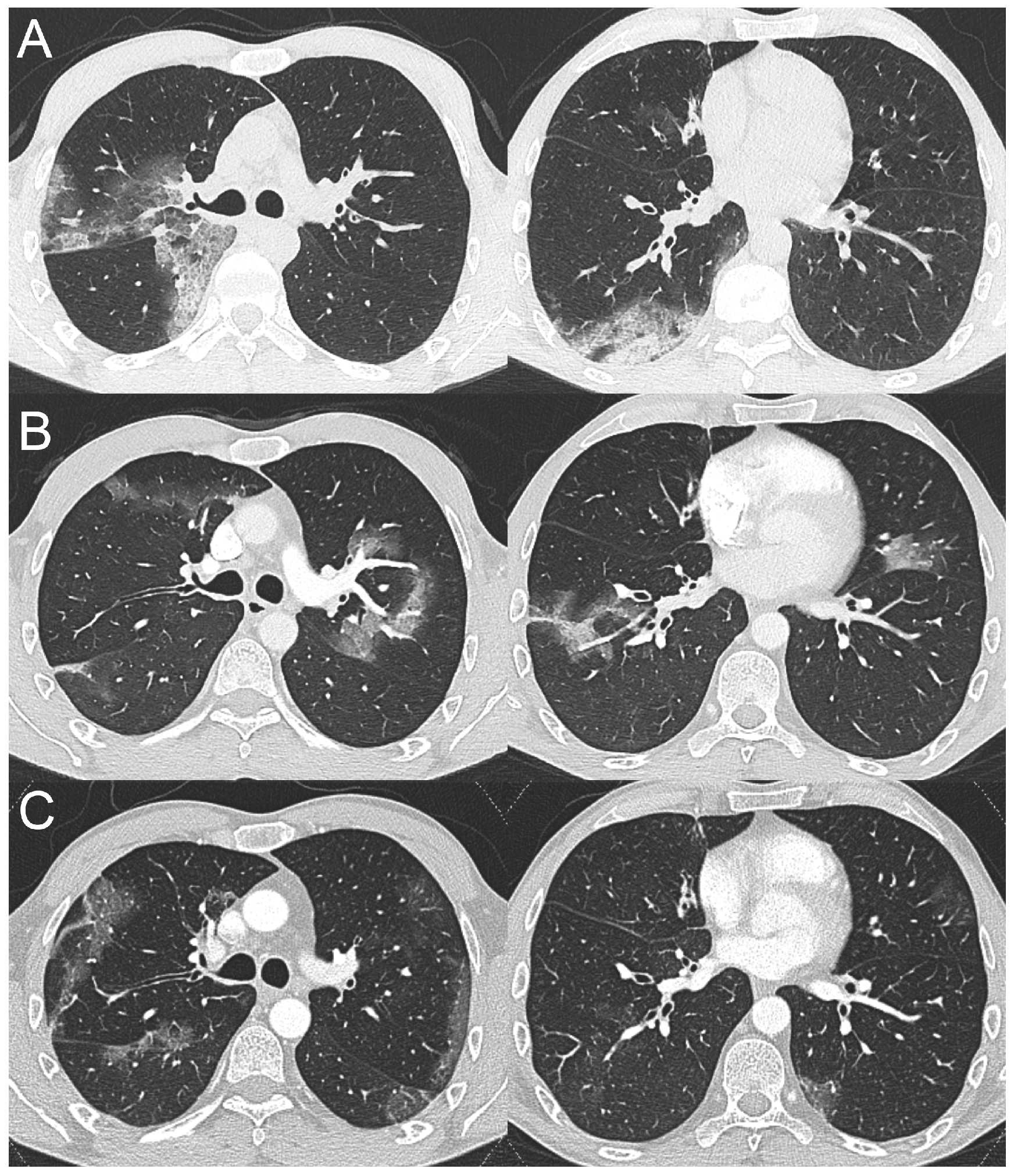 Tomography 09 00073 g002 Tomography 09 00073 g002