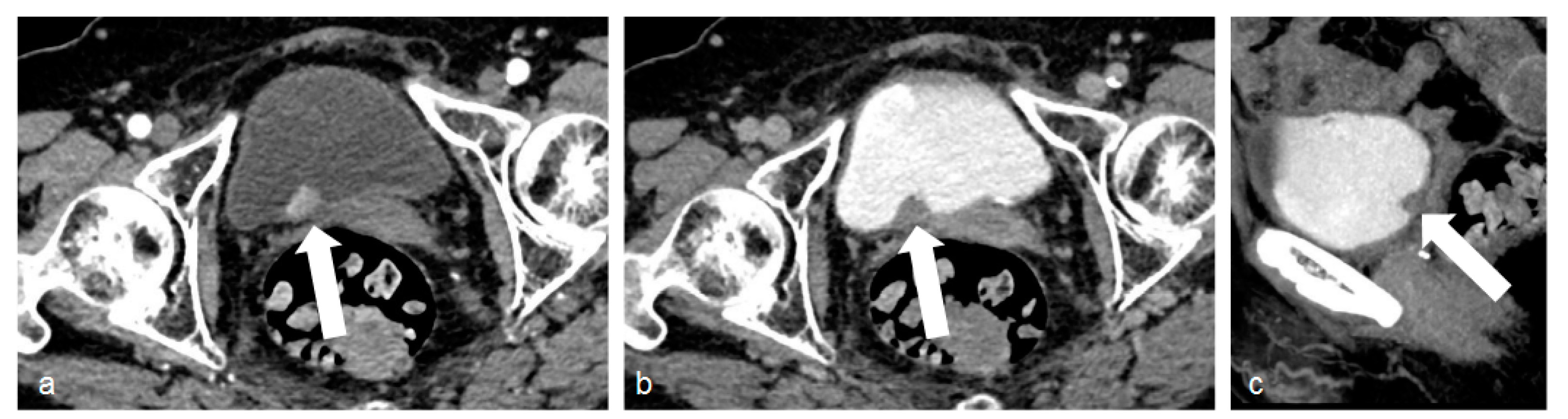 Tomography 09 00075 g001 Tomography 09 00075 g001