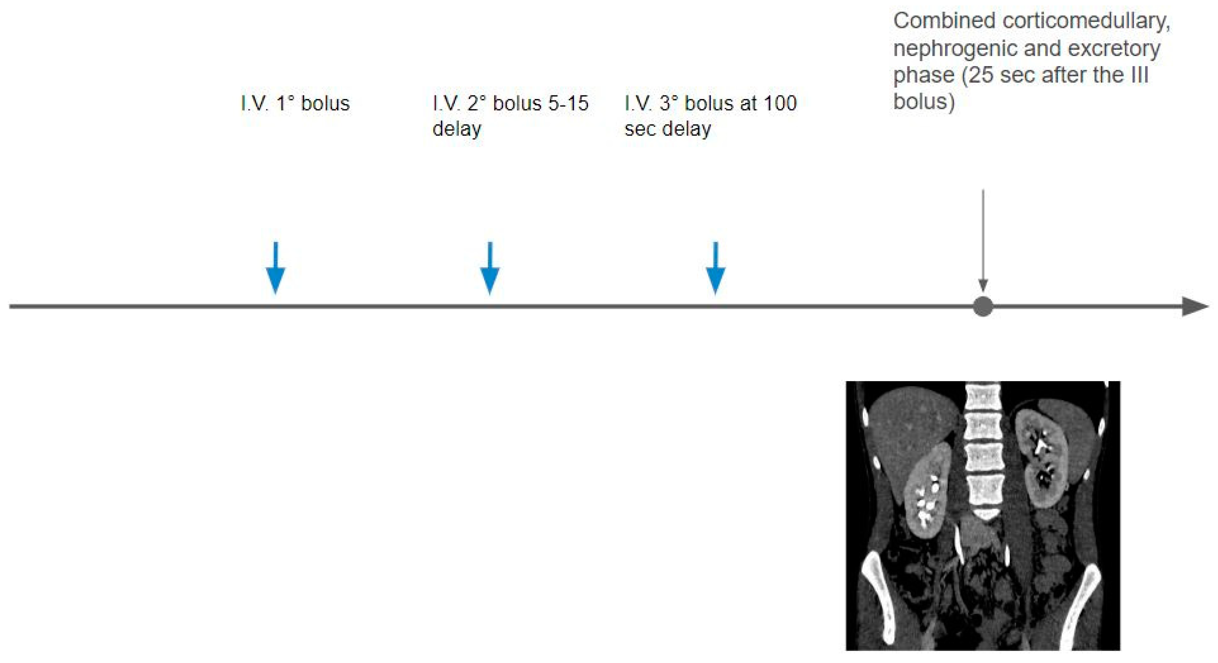 Tomography 09 00075 g005 Tomography 09 00075 g005