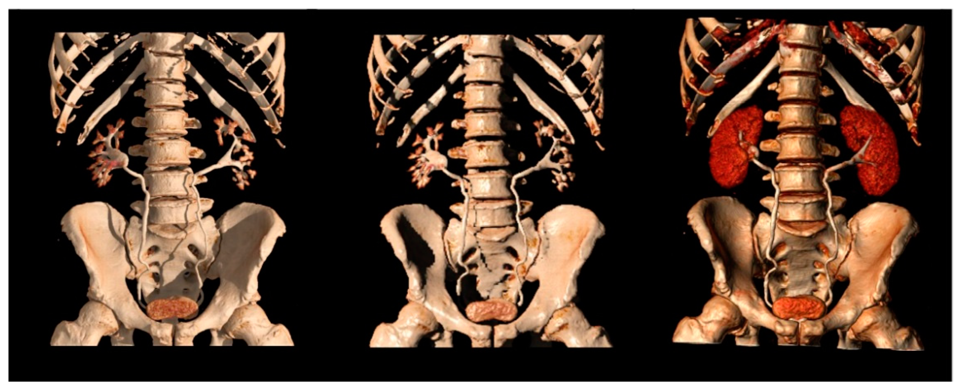 Tomography 09 00075 g007 Tomography 09 00075 g007