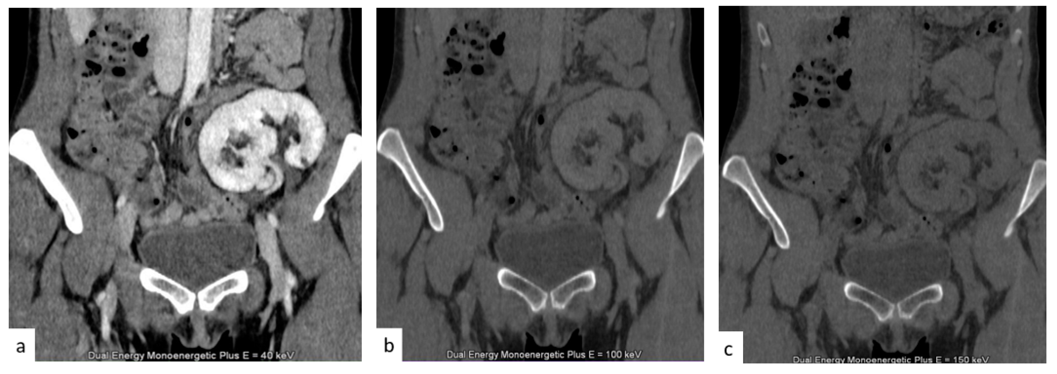 Tomography 09 00075 g008 Tomography 09 00075 g008