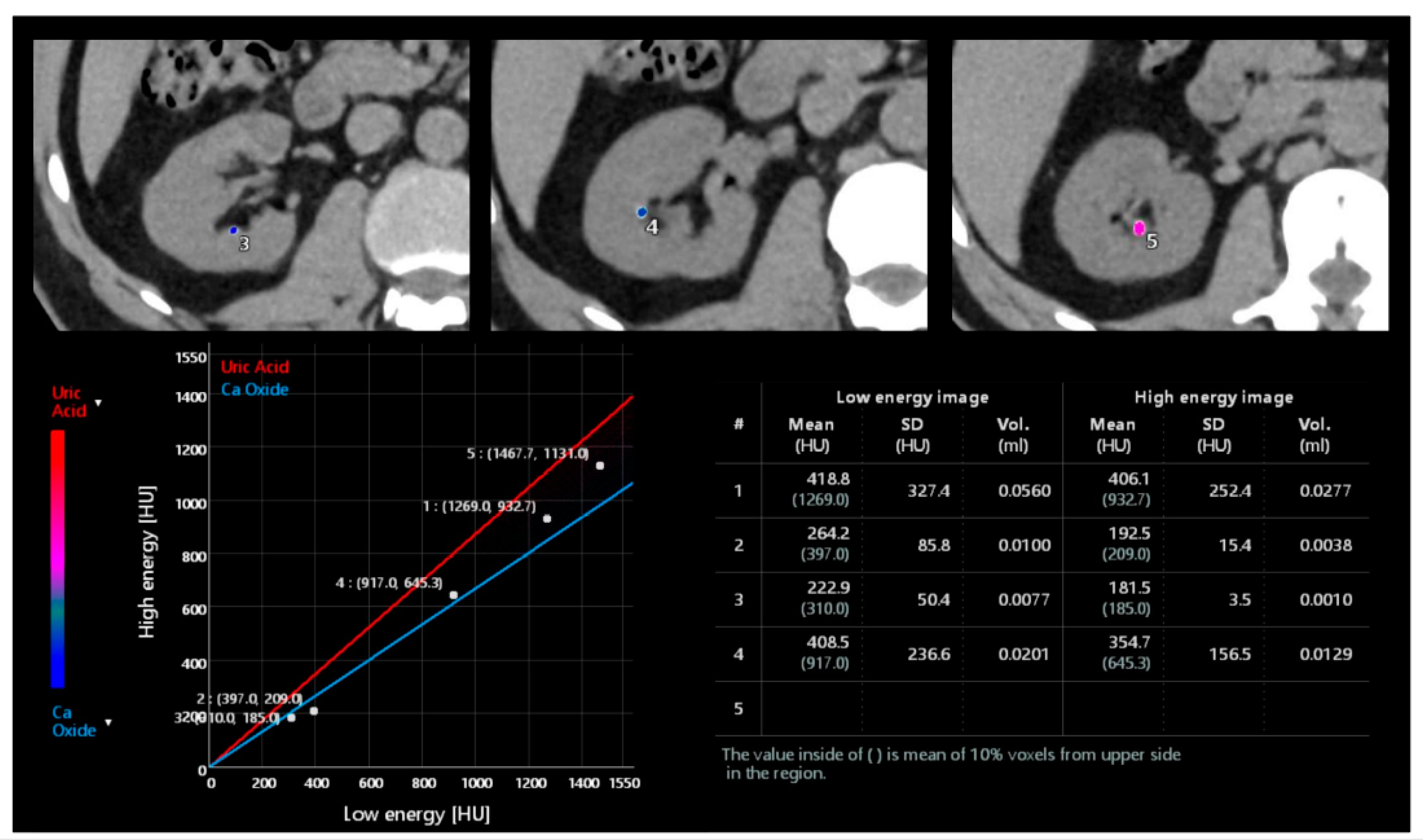 Tomography 09 00075 g009 Tomography 09 00075 g009