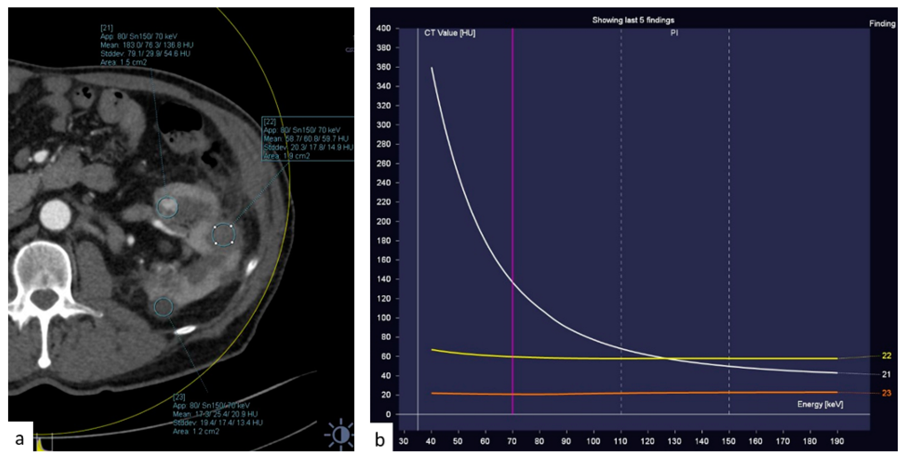 Tomography 09 00075 g011 Tomography 09 00075 g011