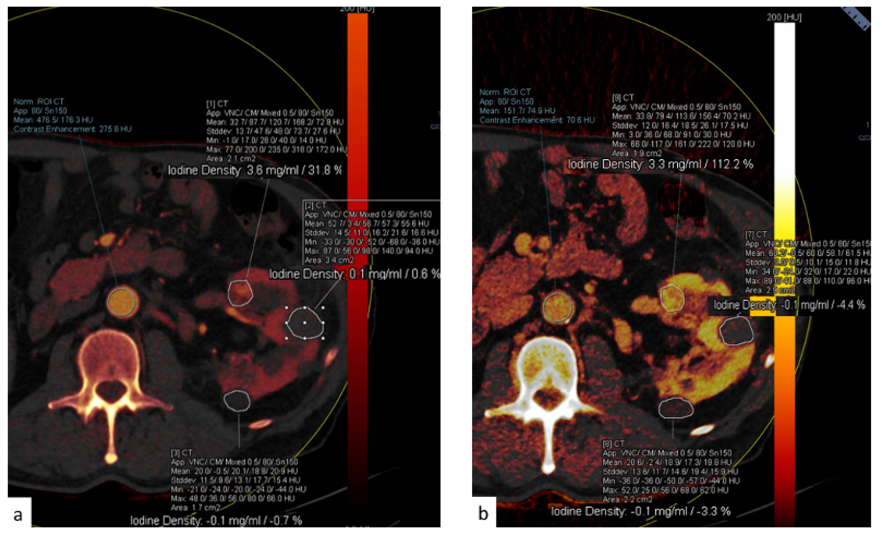 Tomography 09 00075 g012 Tomography 09 00075 g012