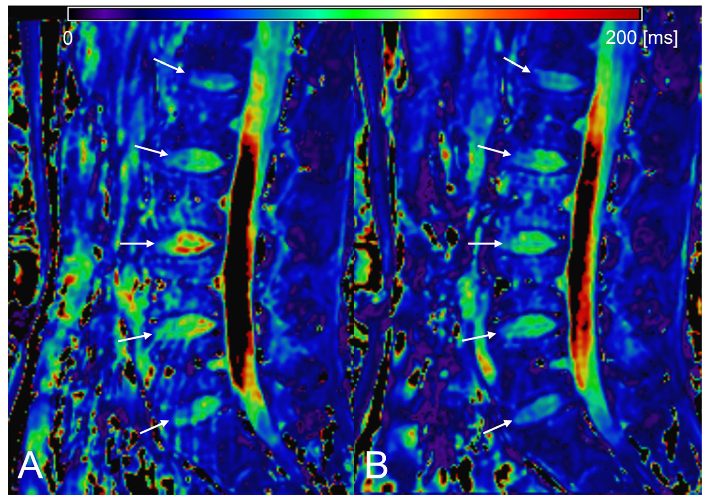 Tomography 09 00084 g002