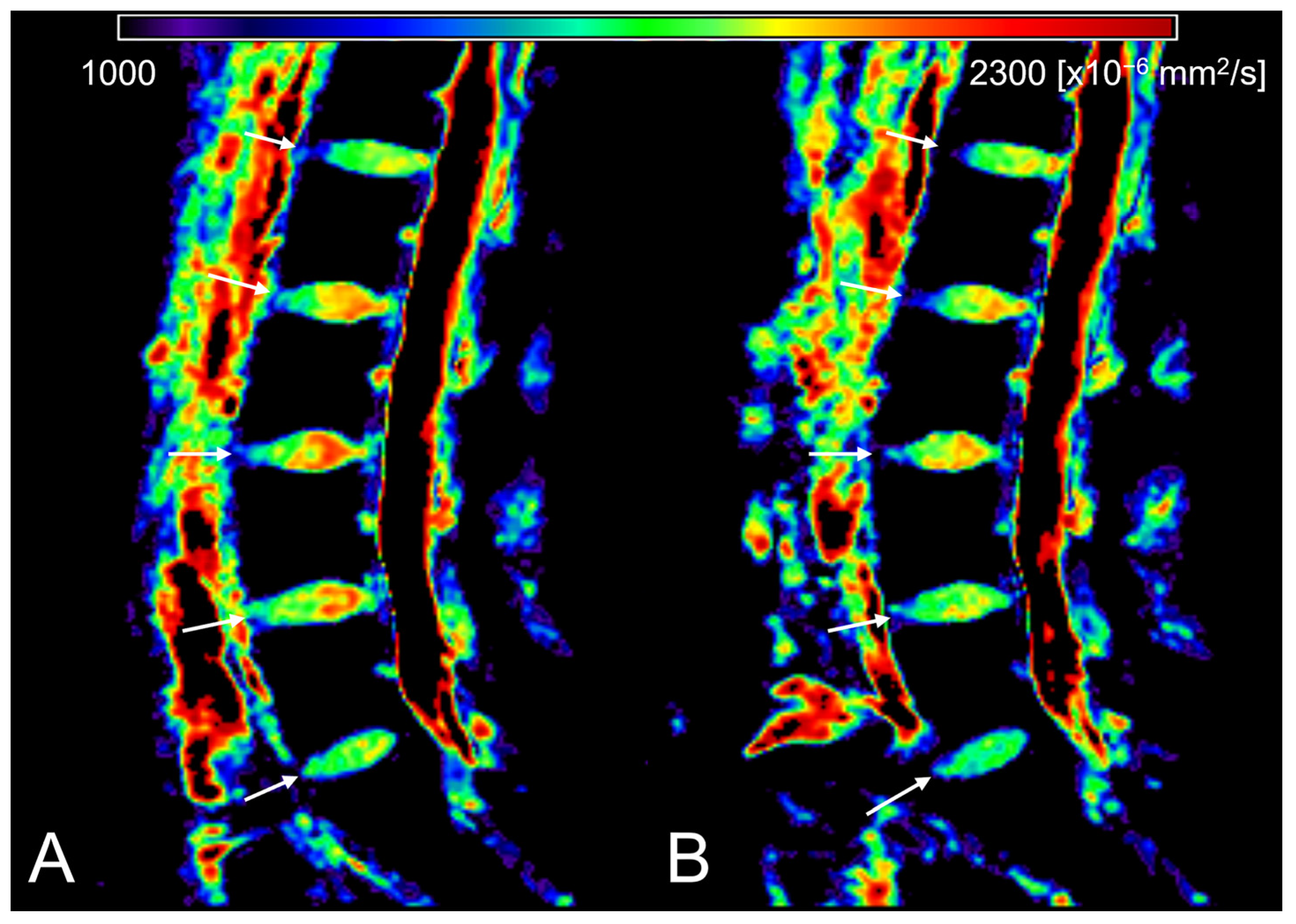 Tomography 09 00084 g003