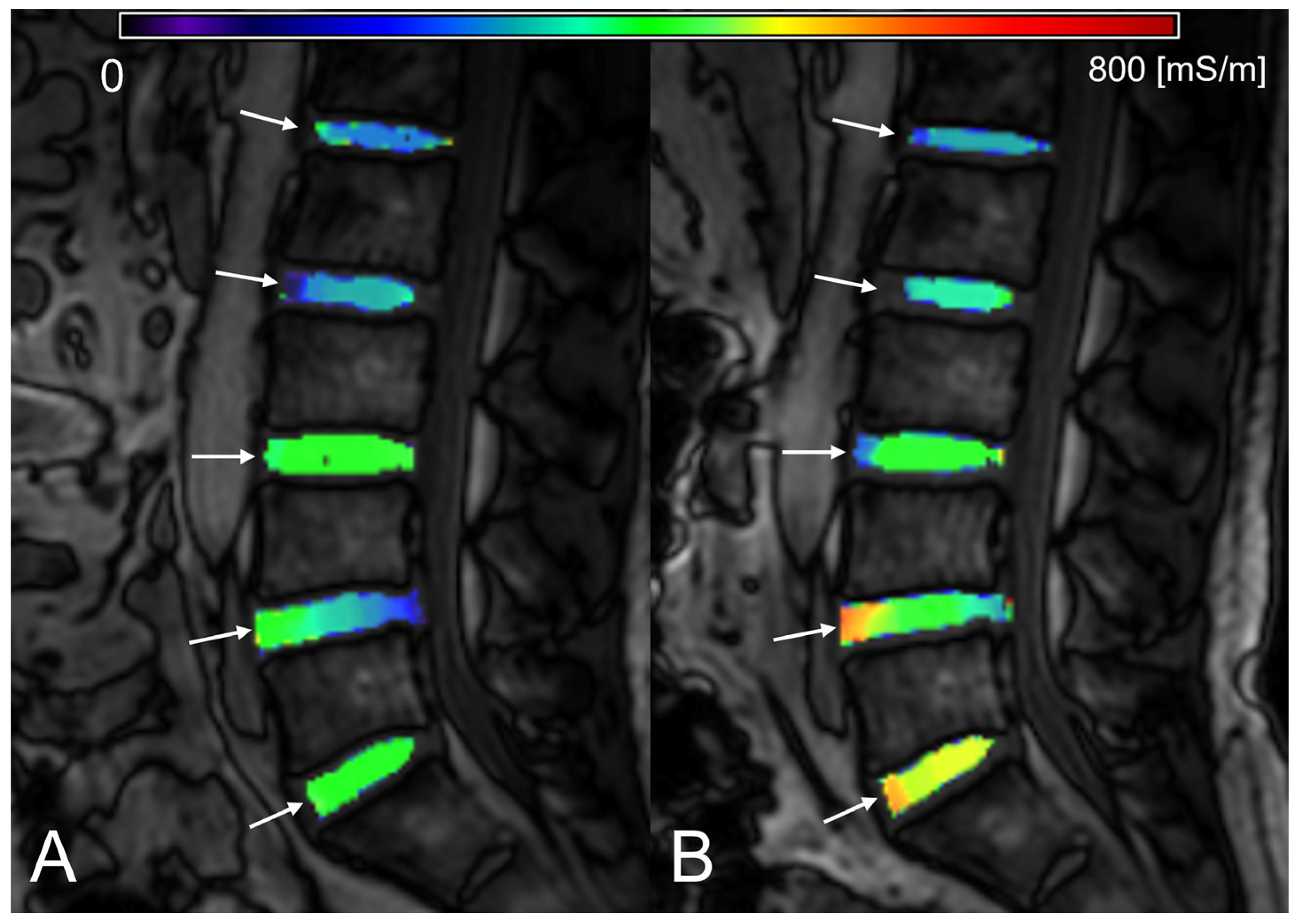 Tomography 09 00084 g004