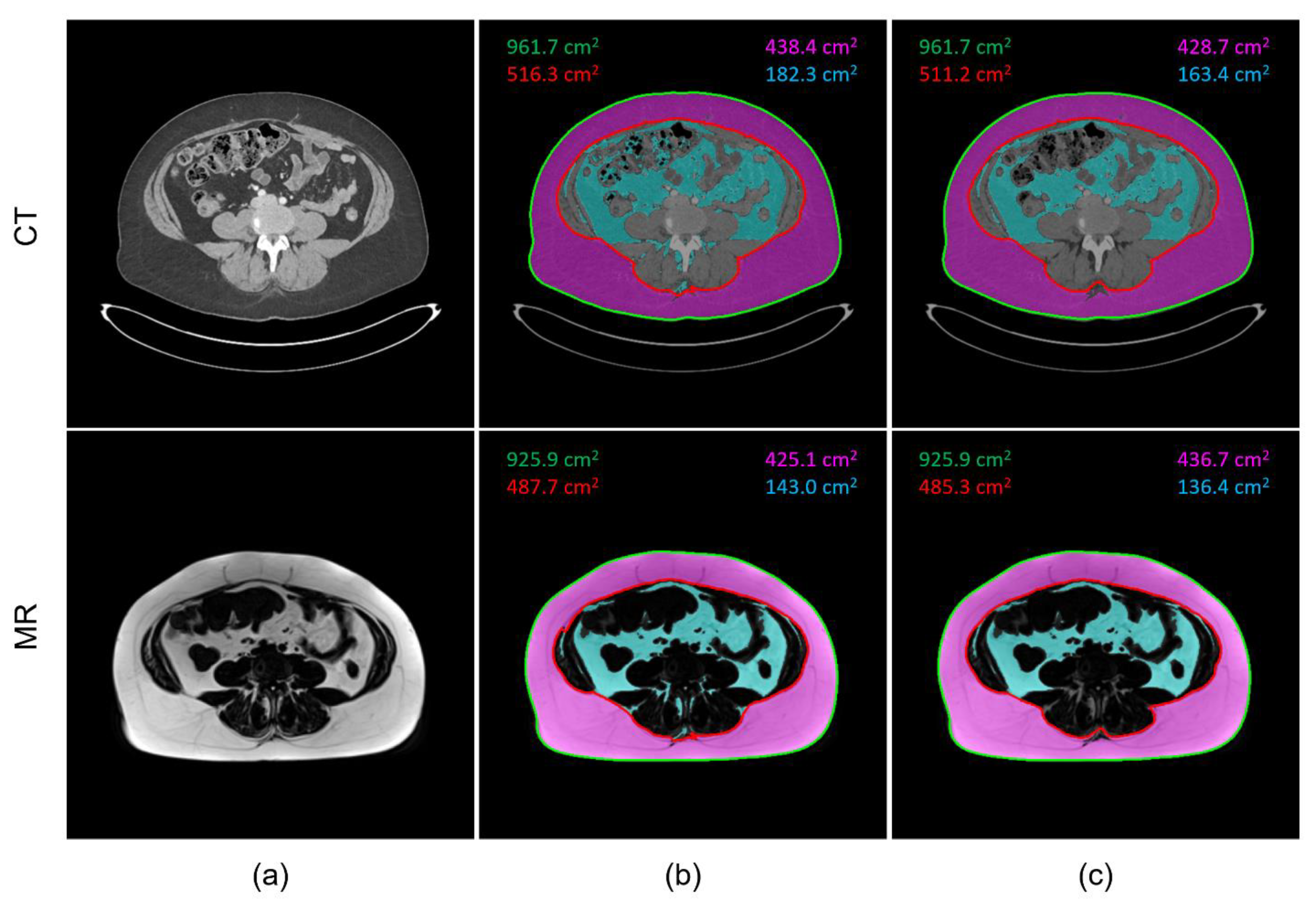 Tomography 09 00085 g002 Tomography 09 00085 g002
