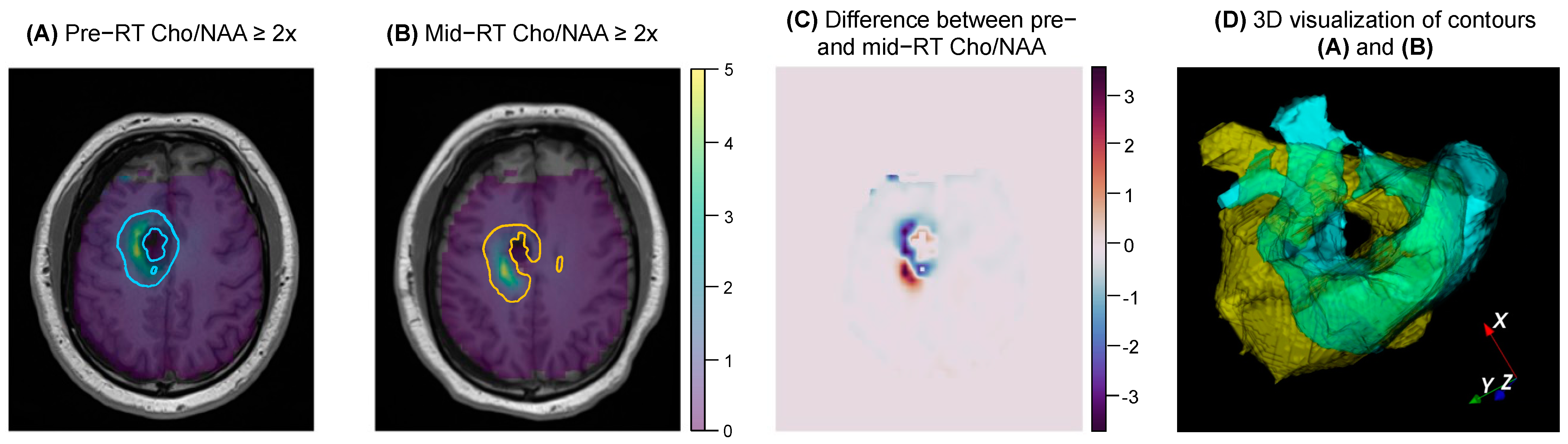 Tomography 09 00086 g002 Tomography 09 00086 g002
