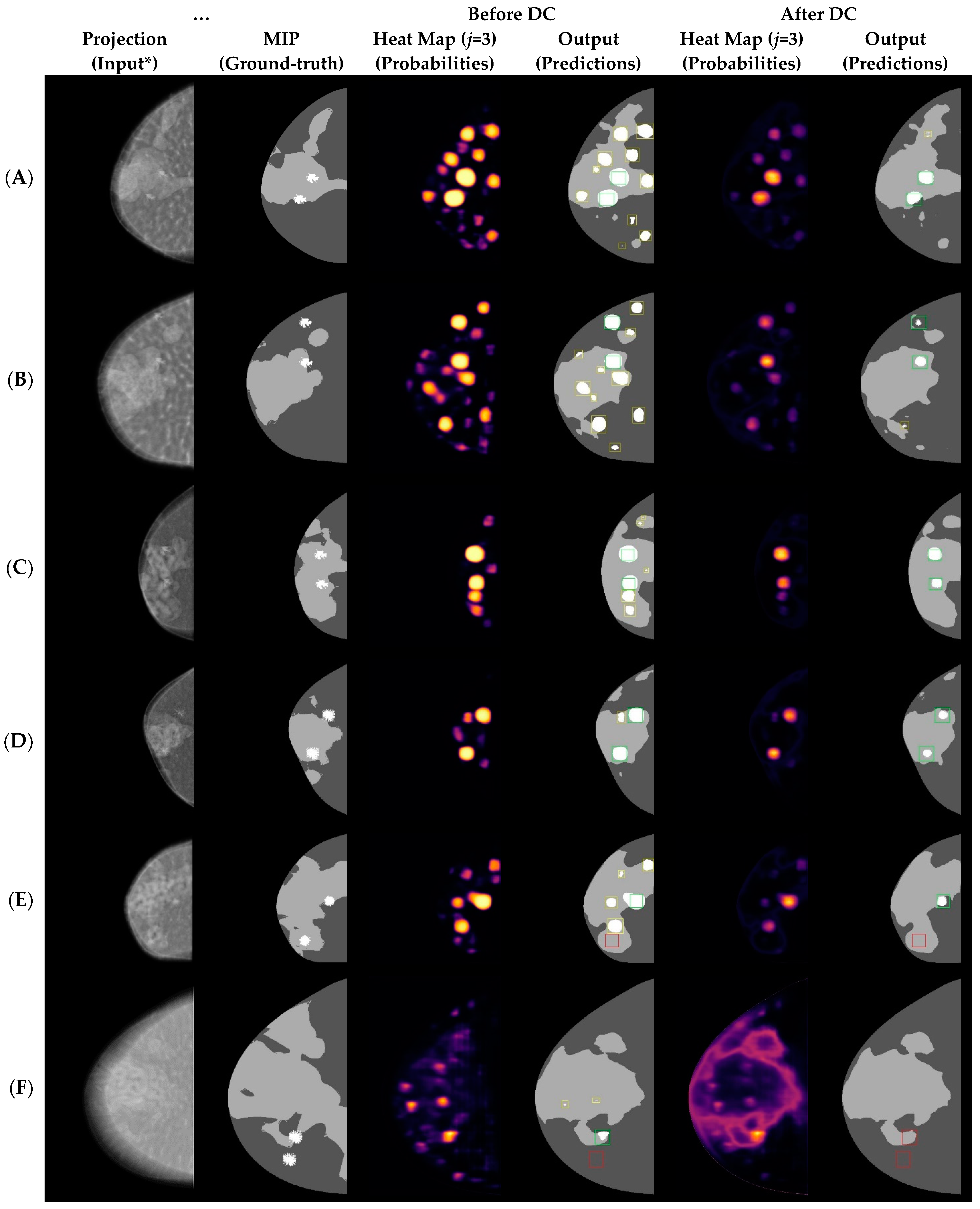 Tomography 09 00092 g004 Tomography 09 00092 g004
