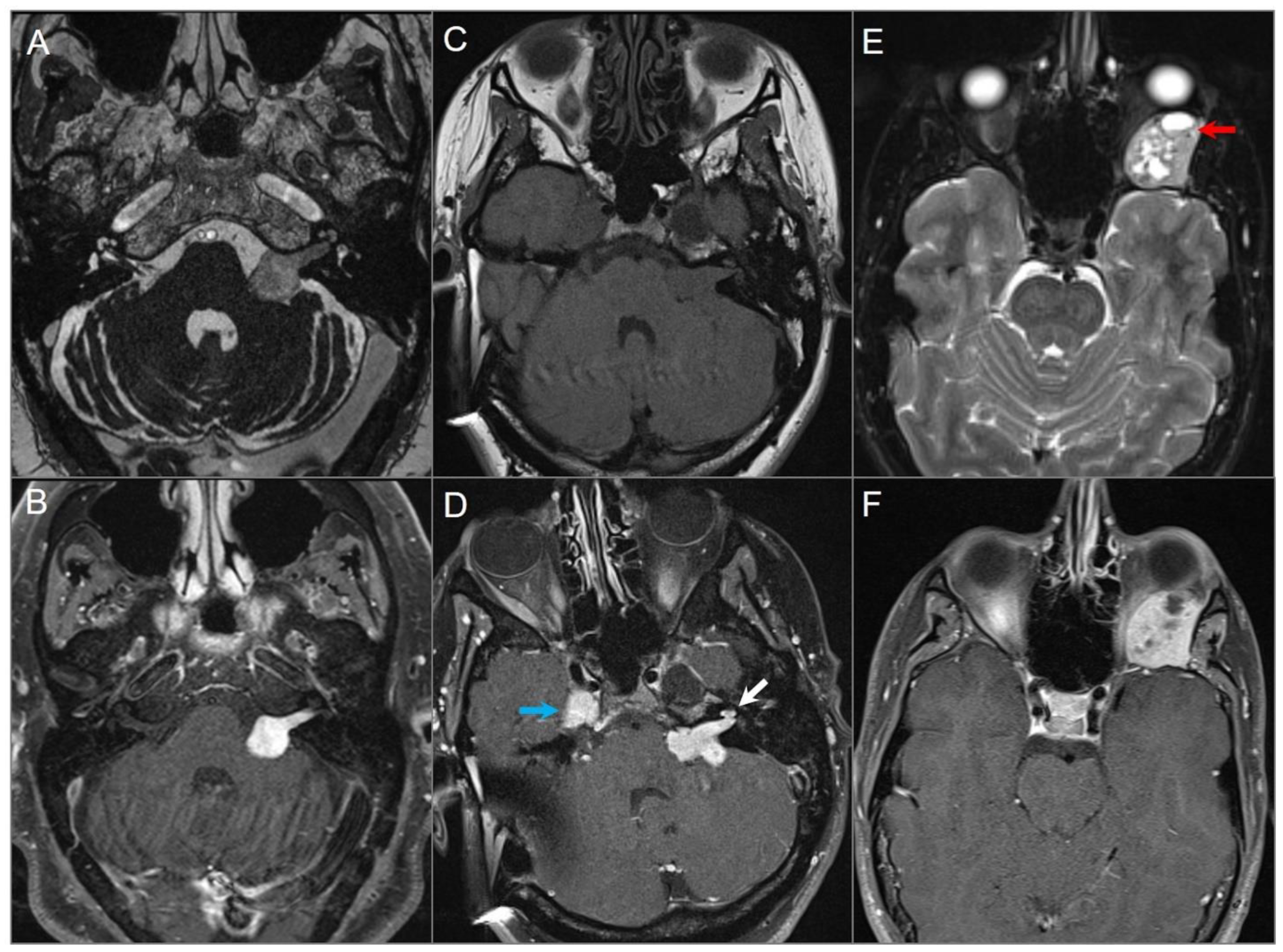 Tomography 09 00097 g003