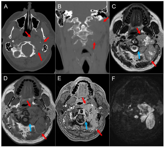 Cranial Magnetic Resonance Imaging 医学書 洋書』 古書・古文書