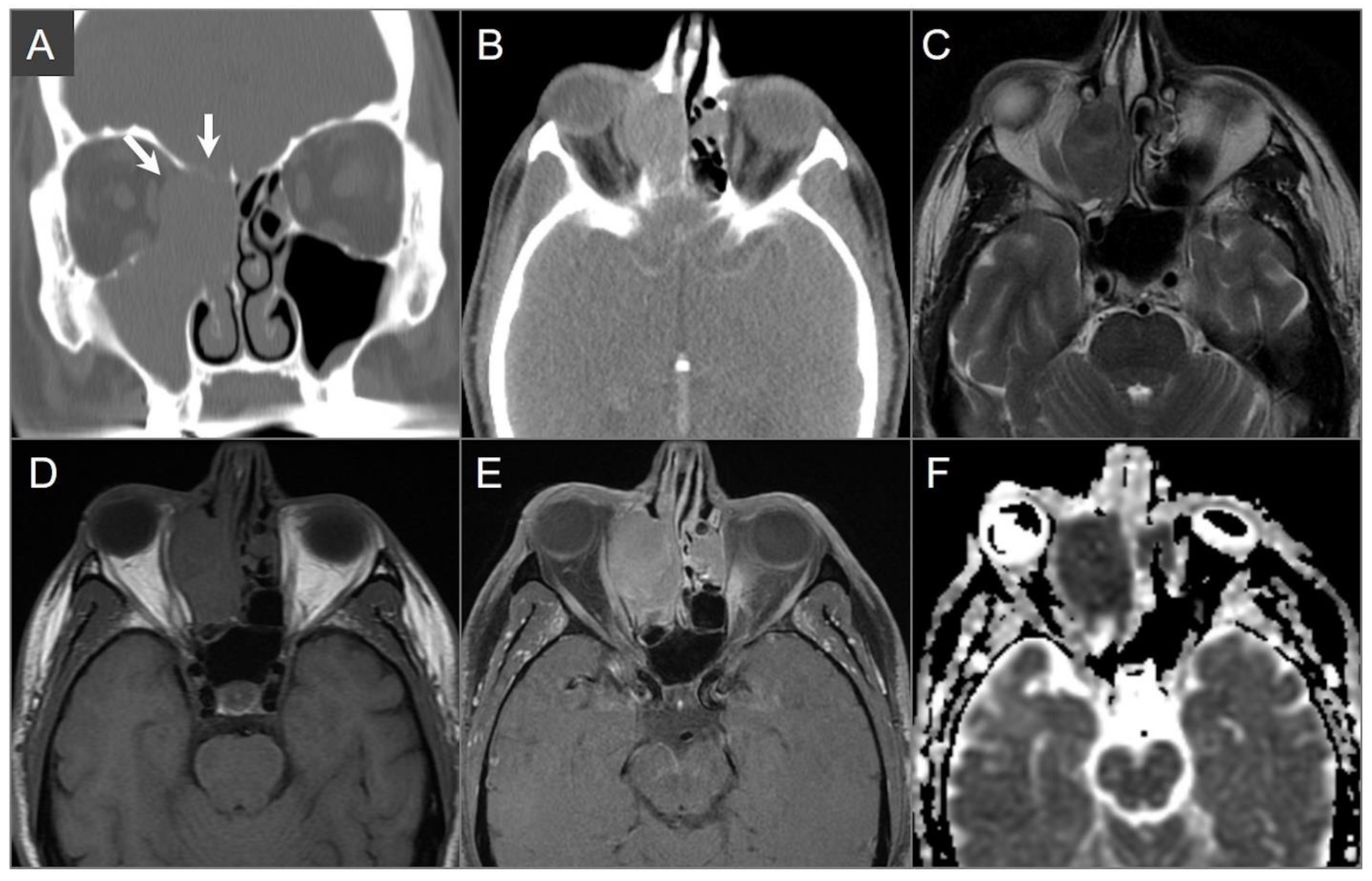 Tomography 09 00097 g005