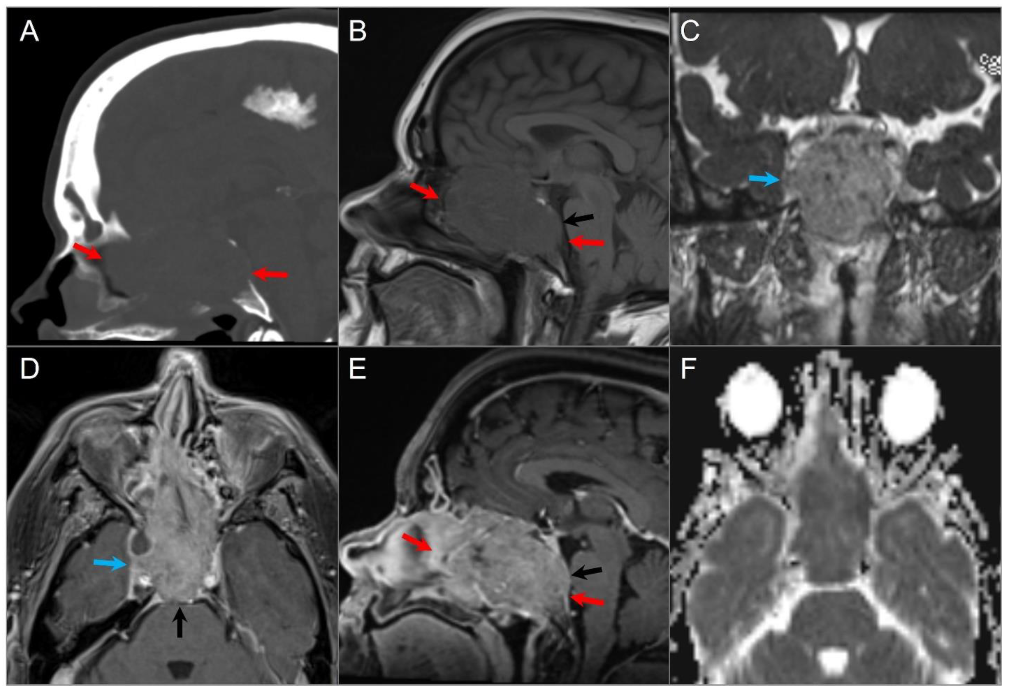 Tomography 09 00097 g007