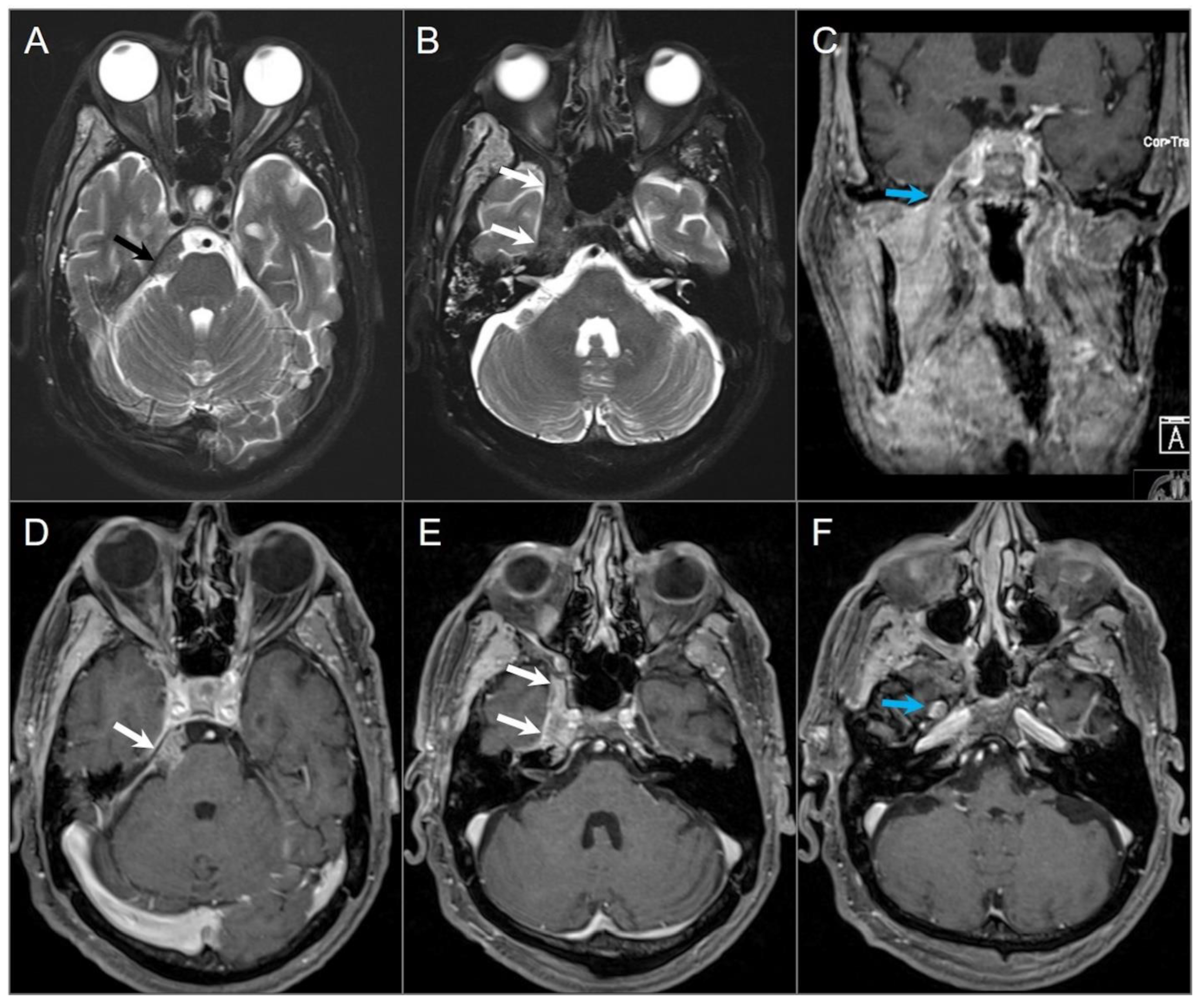 Tomography 09 00097 g008