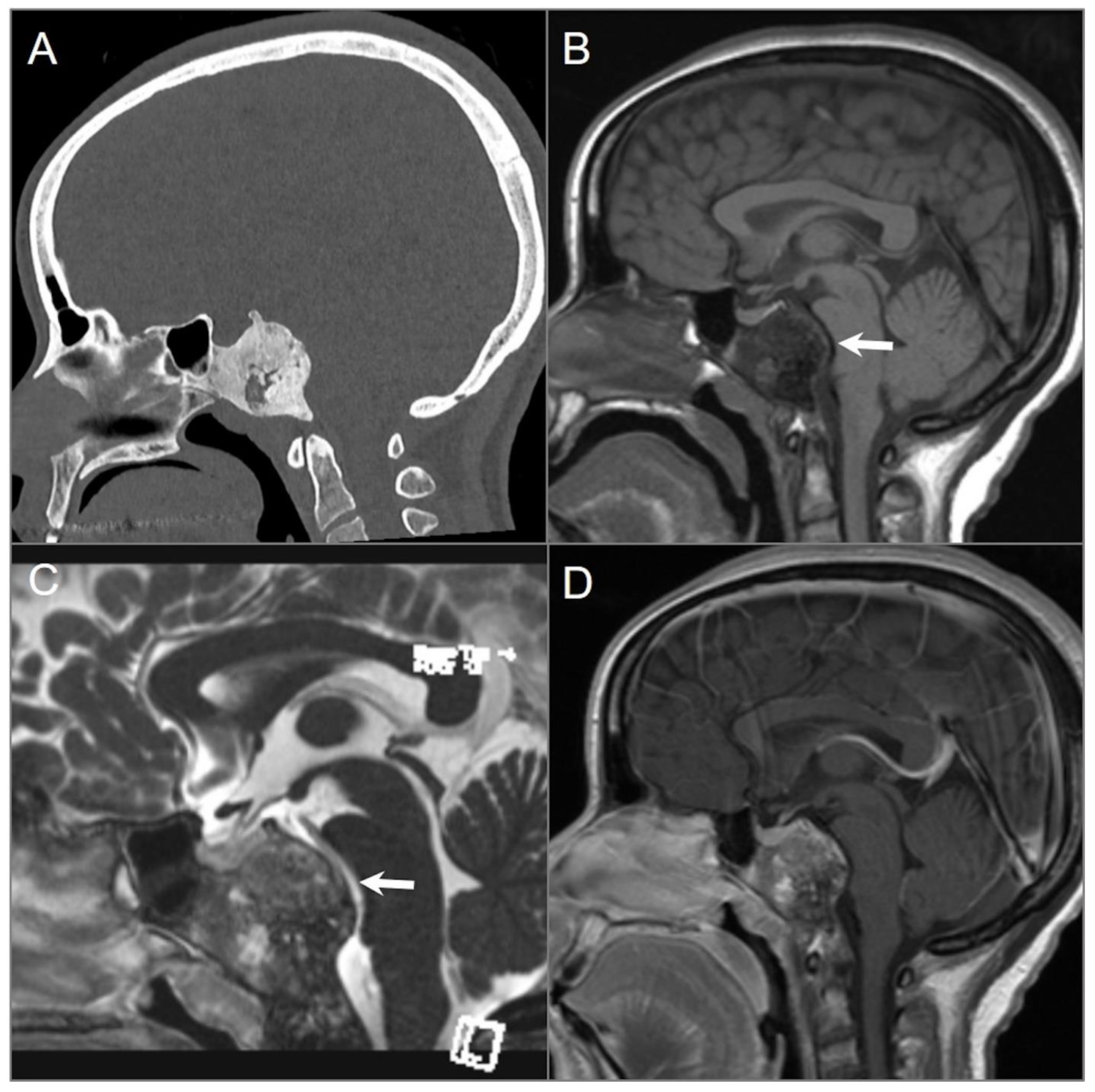 Tomography 09 00097 g009