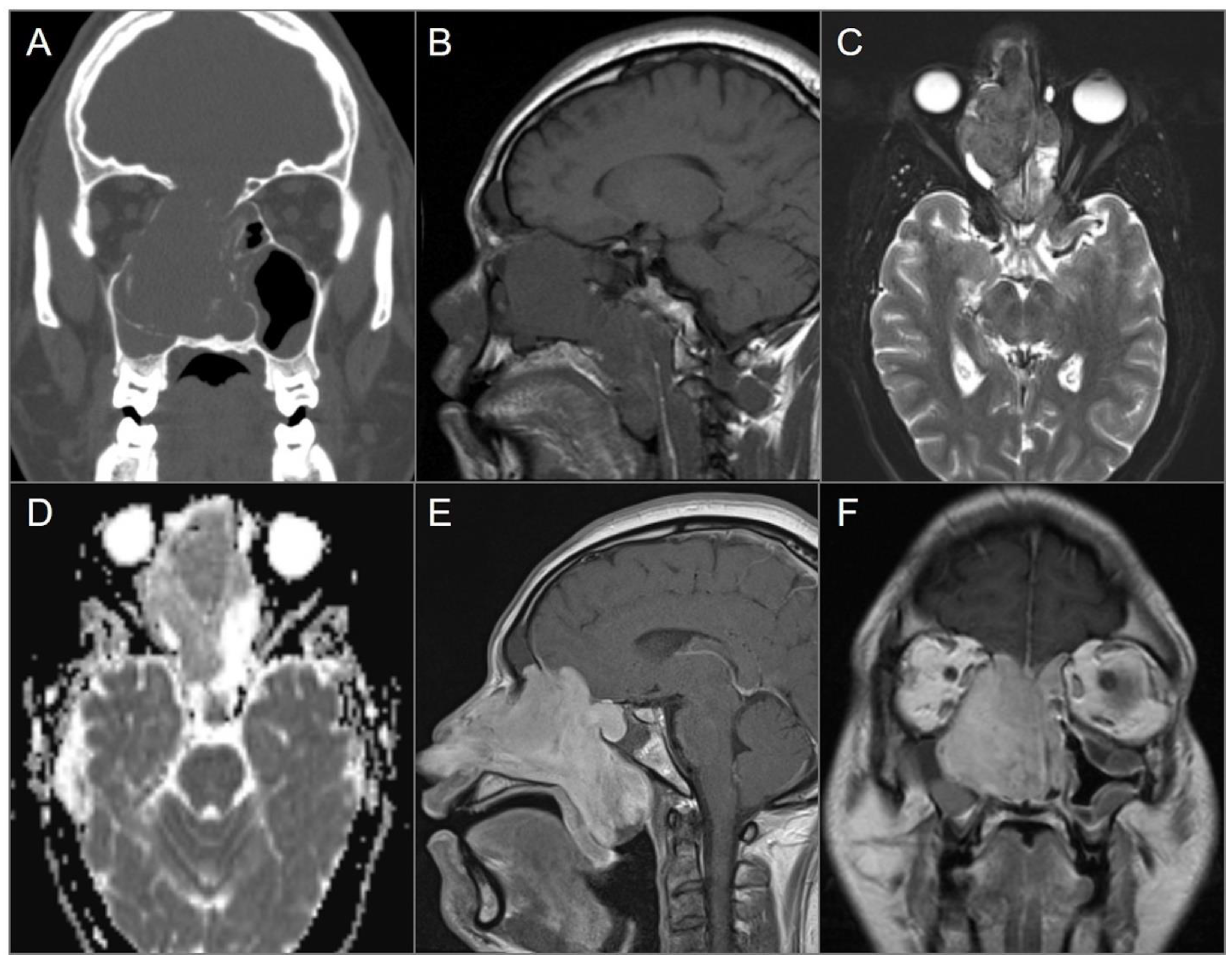 Tomography 09 00097 g010