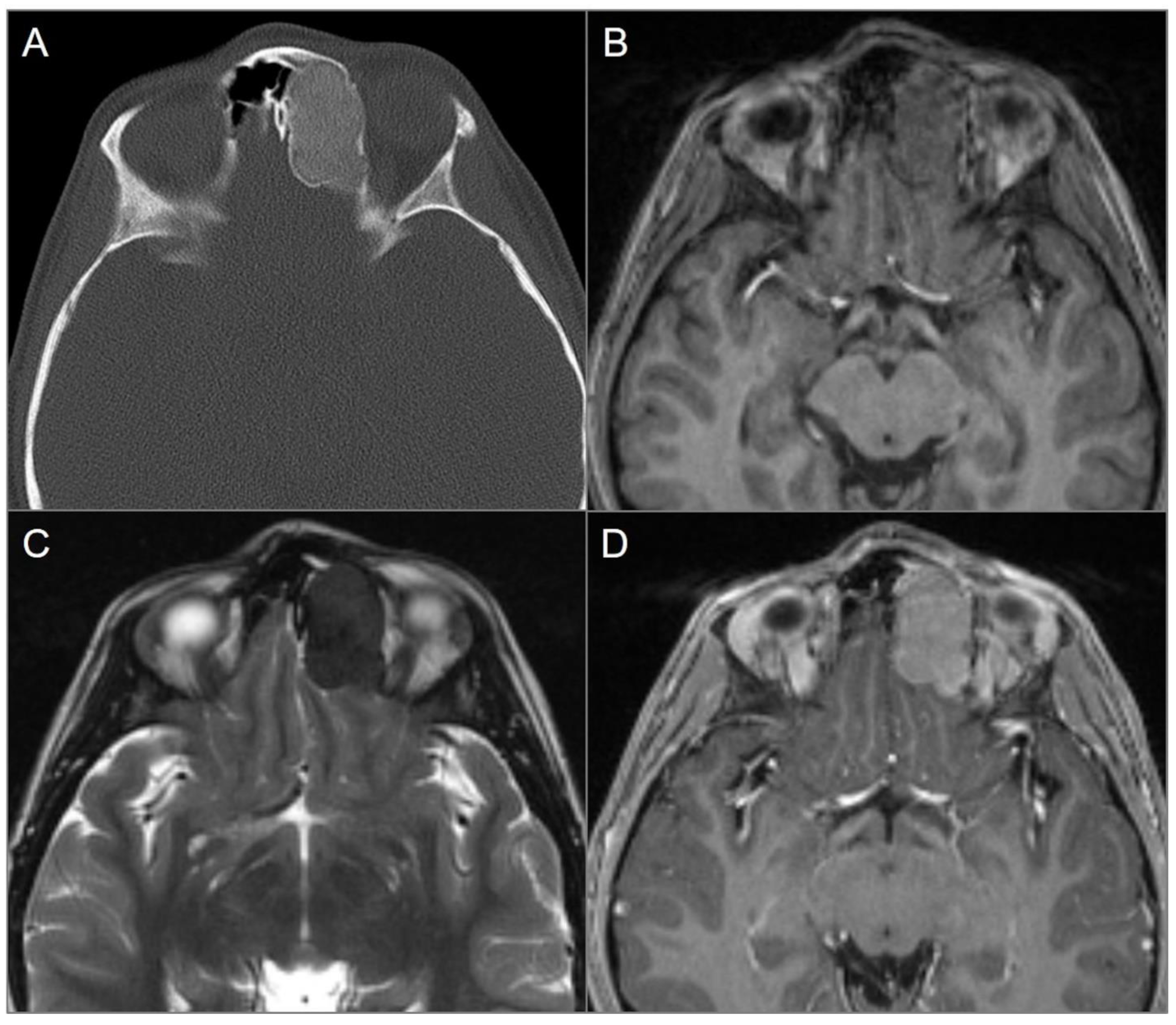 Tomography 09 00097 g011