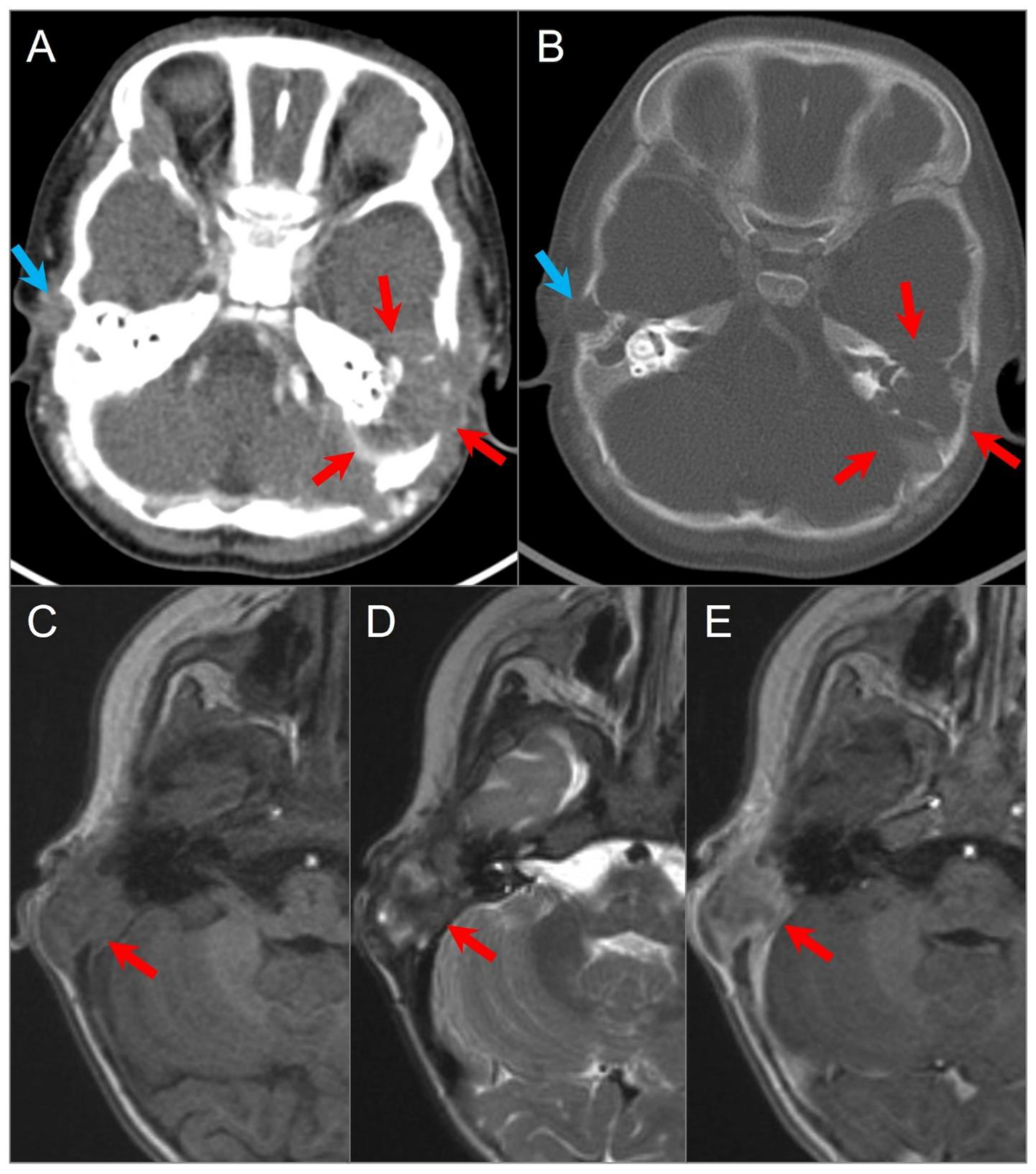 Tomography 09 00097 g017