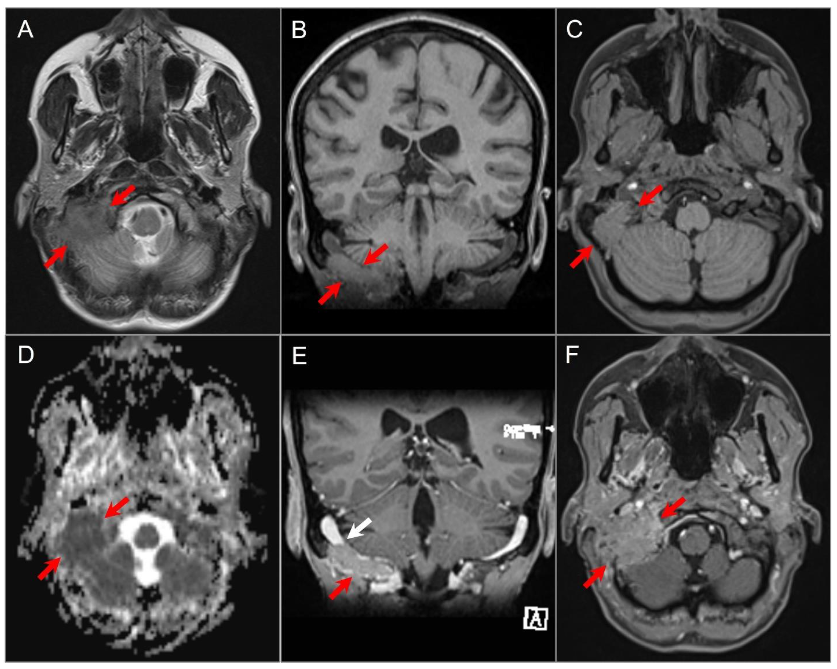 Tomography 09 00097 g021