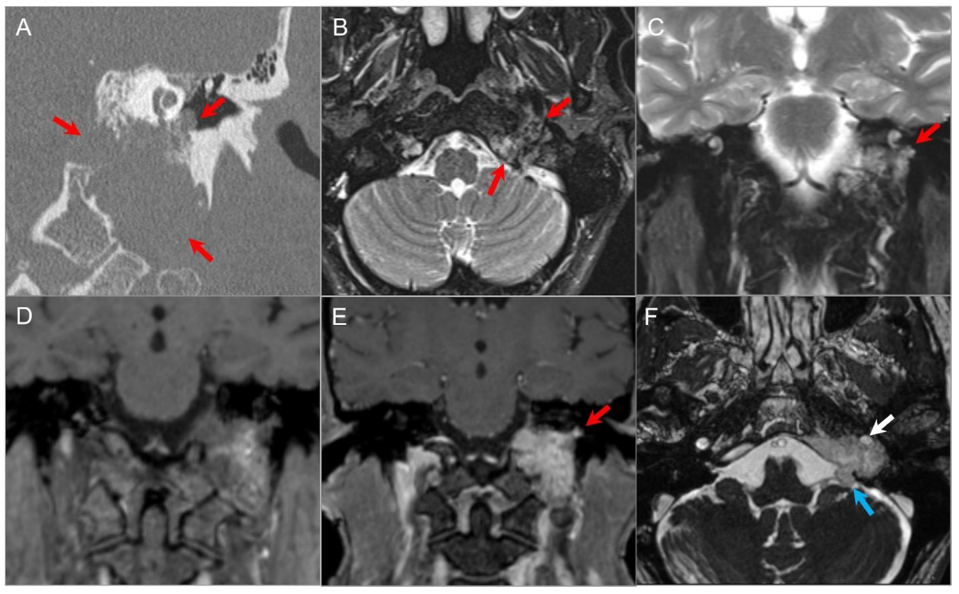 Tomography 09 00097 g023