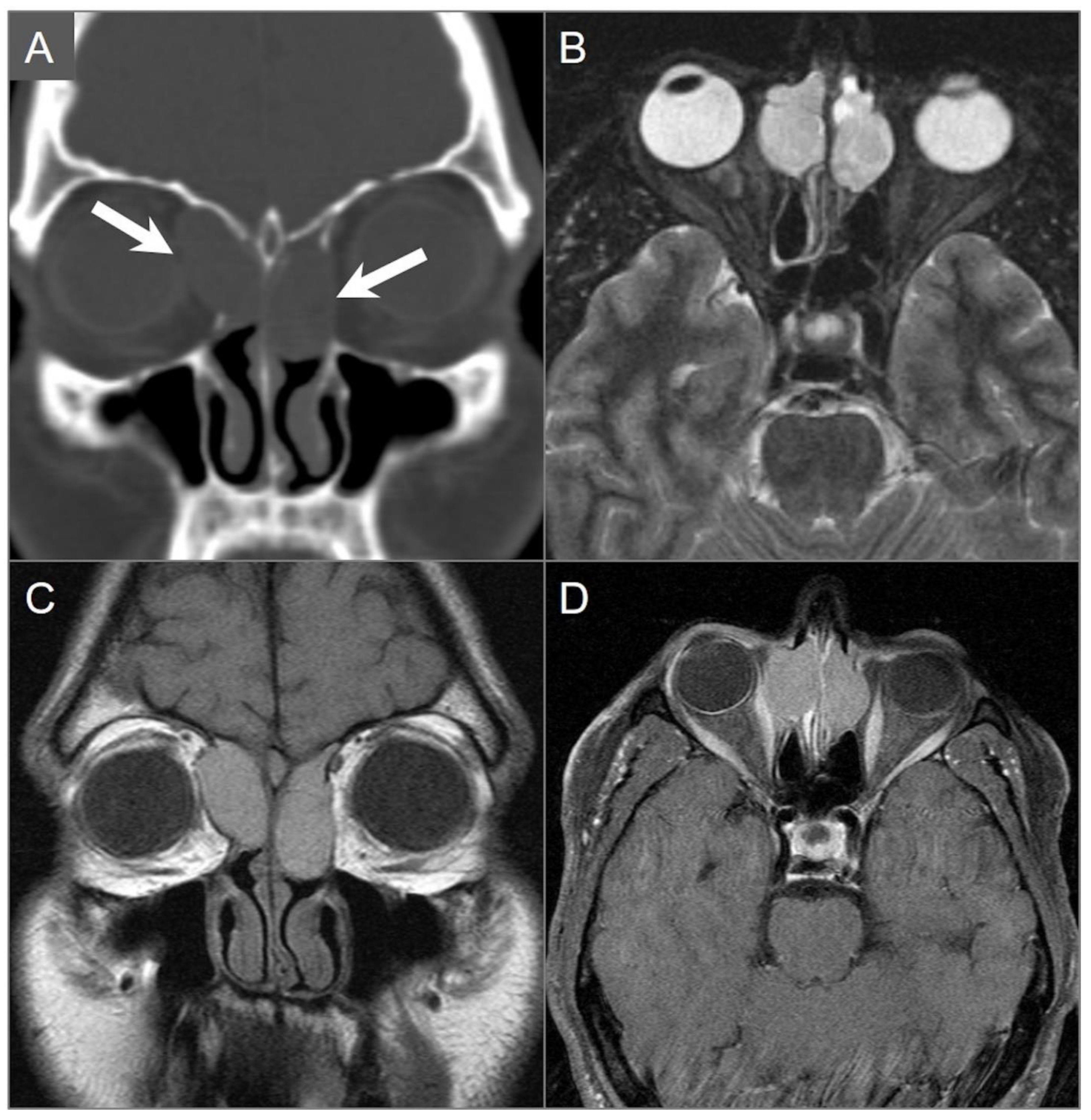 Tomography 09 00097 g028