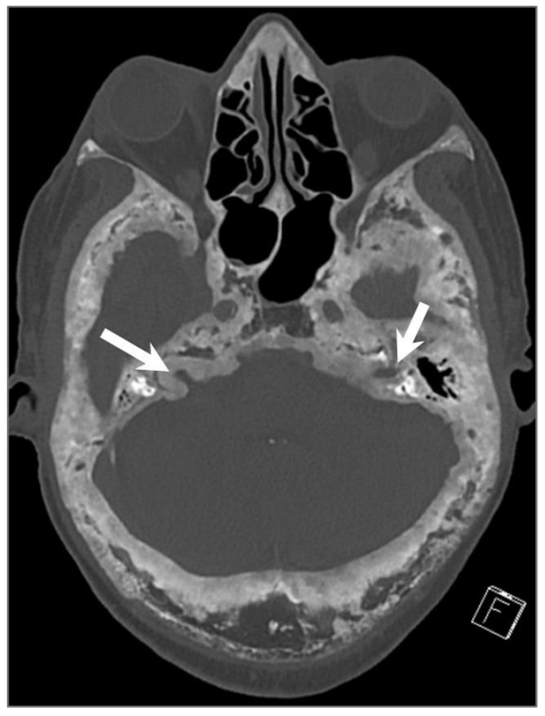 Tomography 09 00097 g031