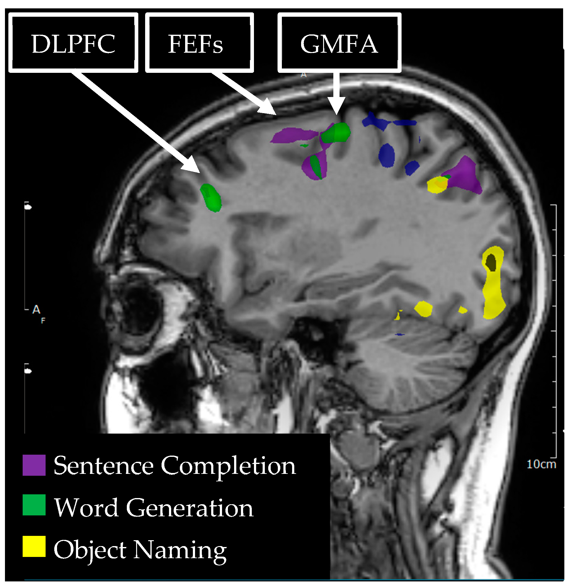 Tomography 09 00100 g003 Tomography 09 00100 g003