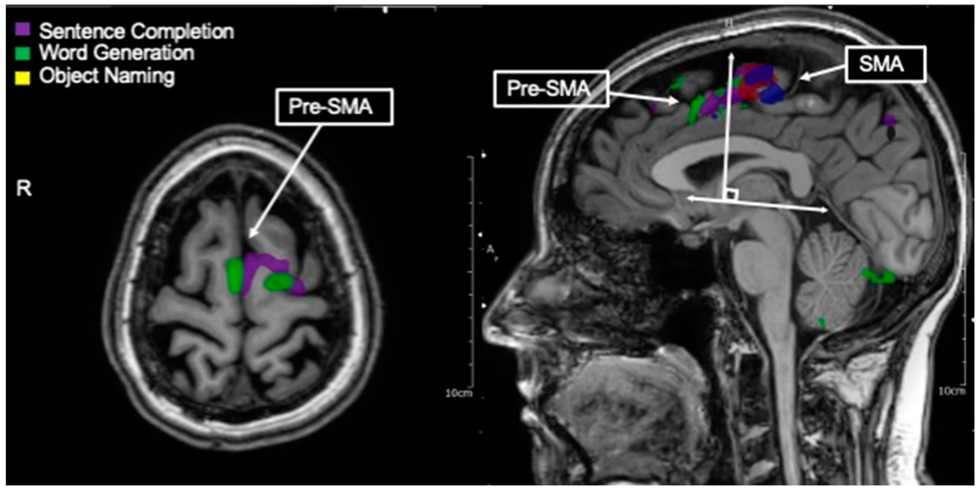 Tomography 09 00100 g004 Tomography 09 00100 g004