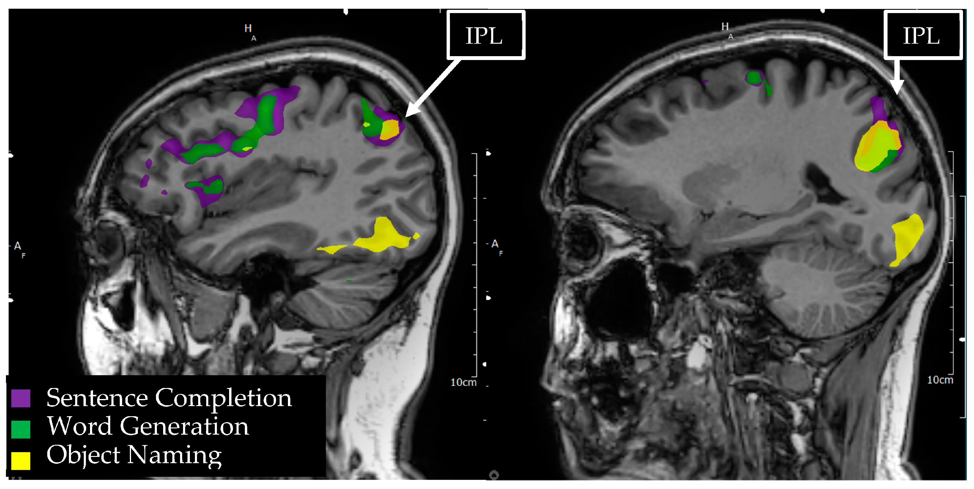 Tomography 09 00100 g005 Tomography 09 00100 g005